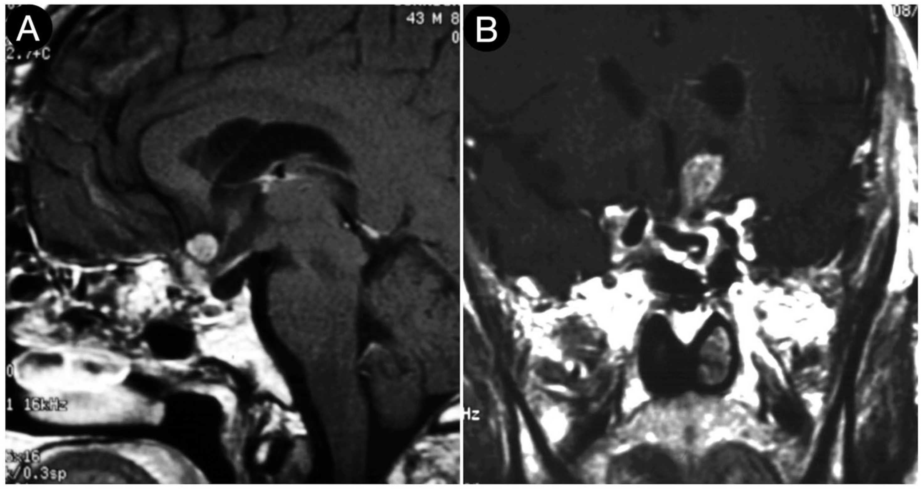 Cancers 15 02235 g010 Cancers 15 02235 g010