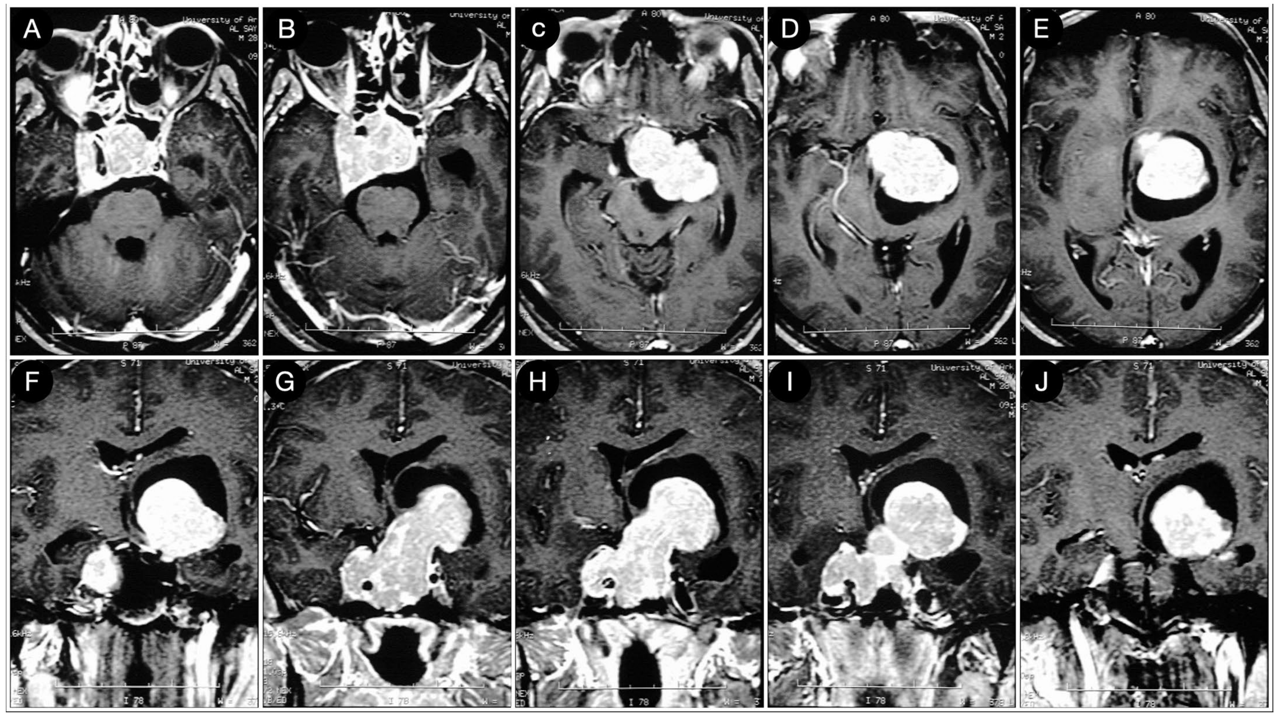 Cancers 15 02235 g011 Cancers 15 02235 g011