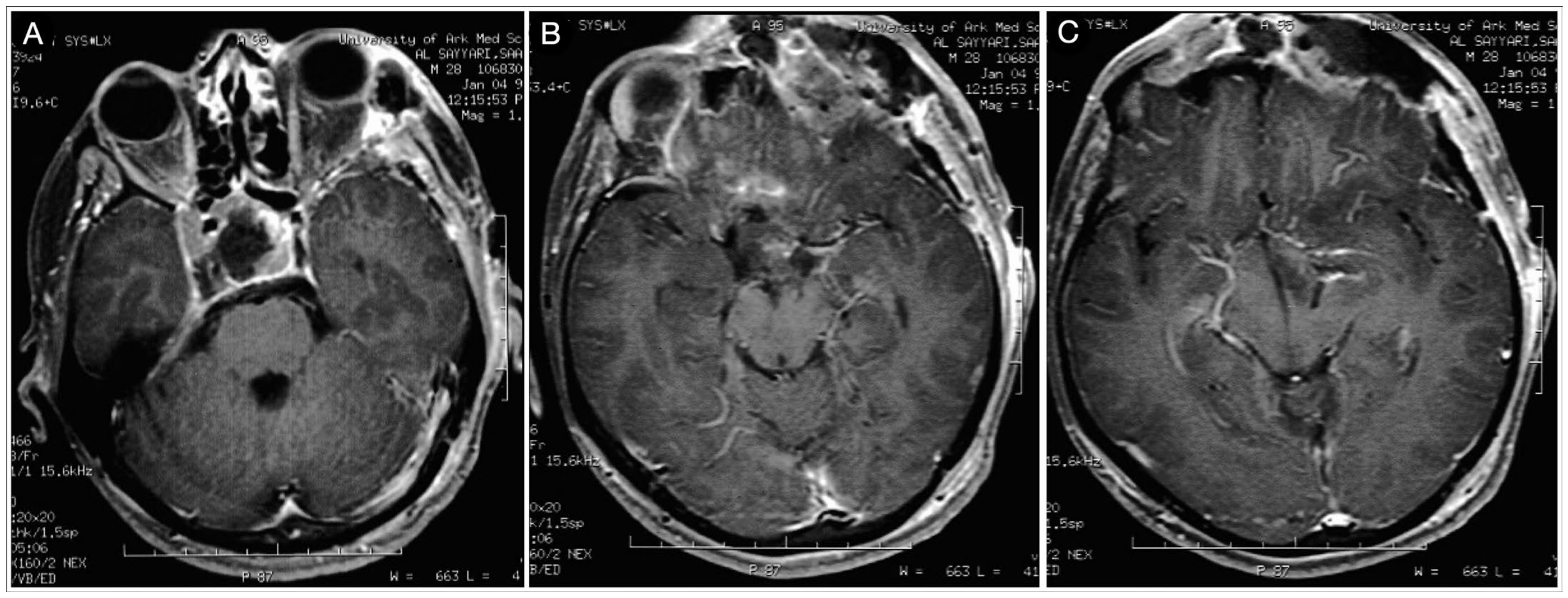 Cancers 15 02235 g012 Cancers 15 02235 g012