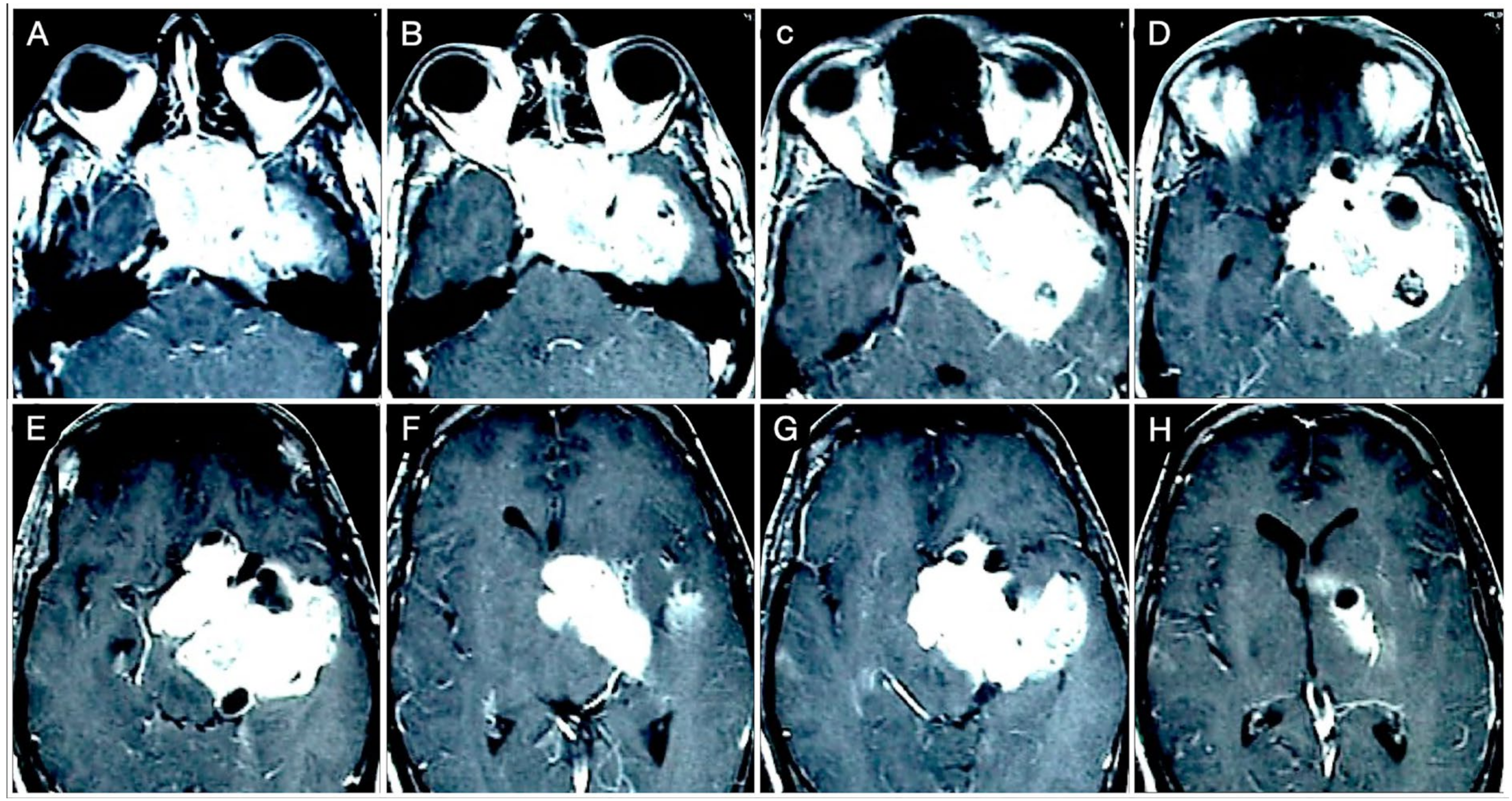 Cancers 15 02235 g014 Cancers 15 02235 g014
