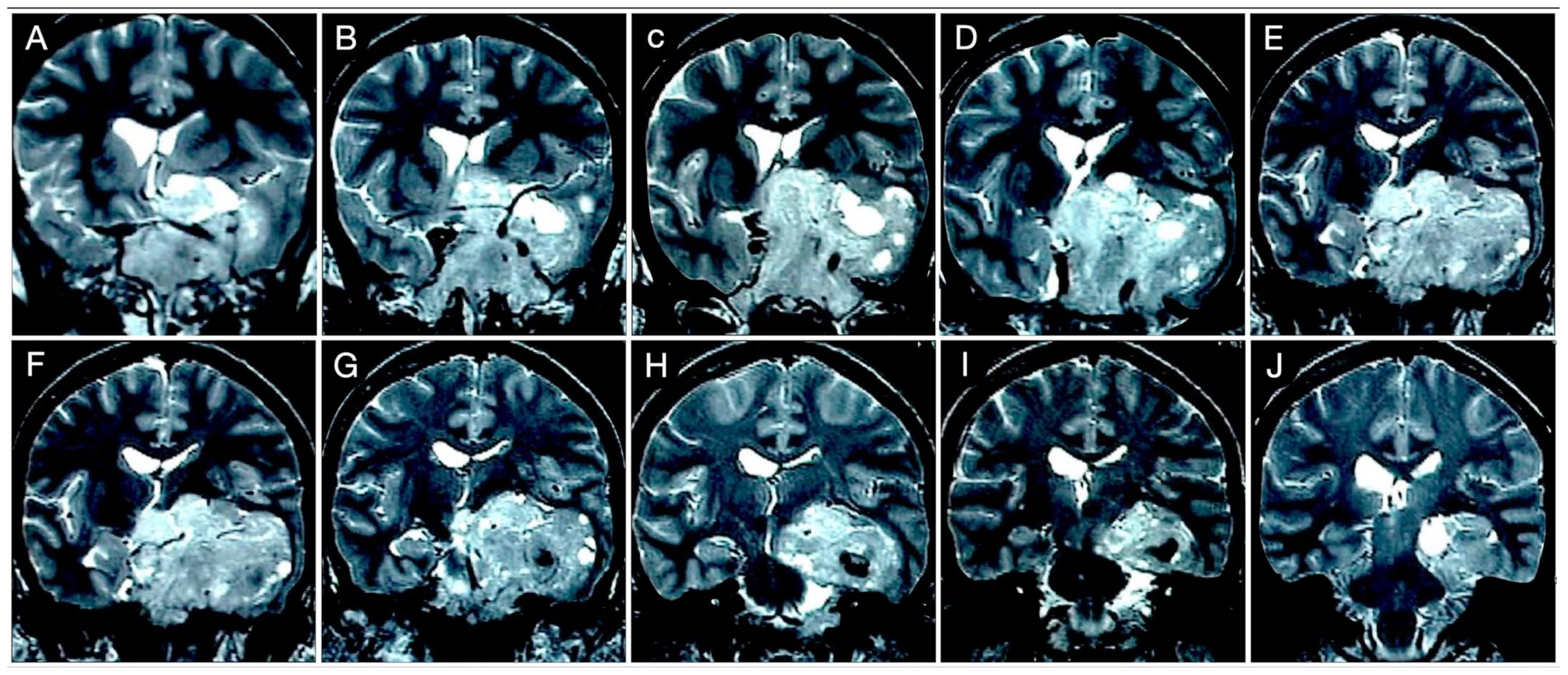Cancers 15 02235 g015 Cancers 15 02235 g015
