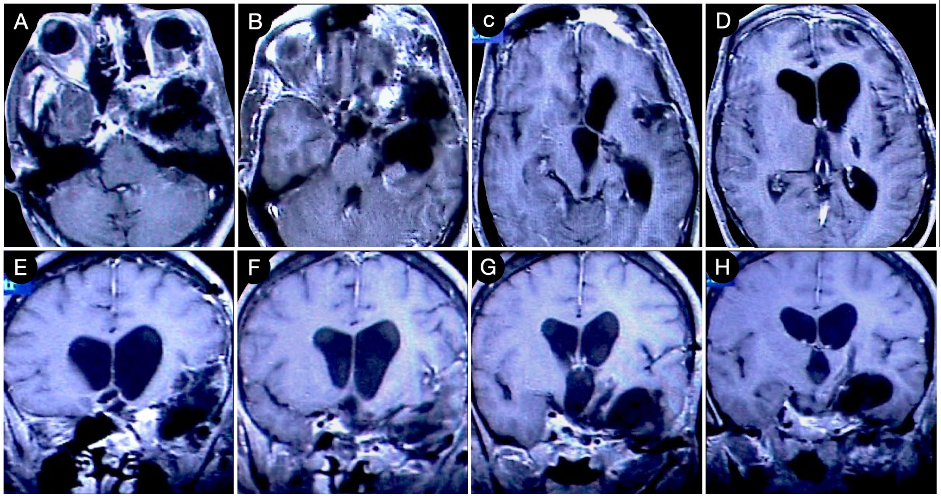 Cancers 15 02235 g017 Cancers 15 02235 g017