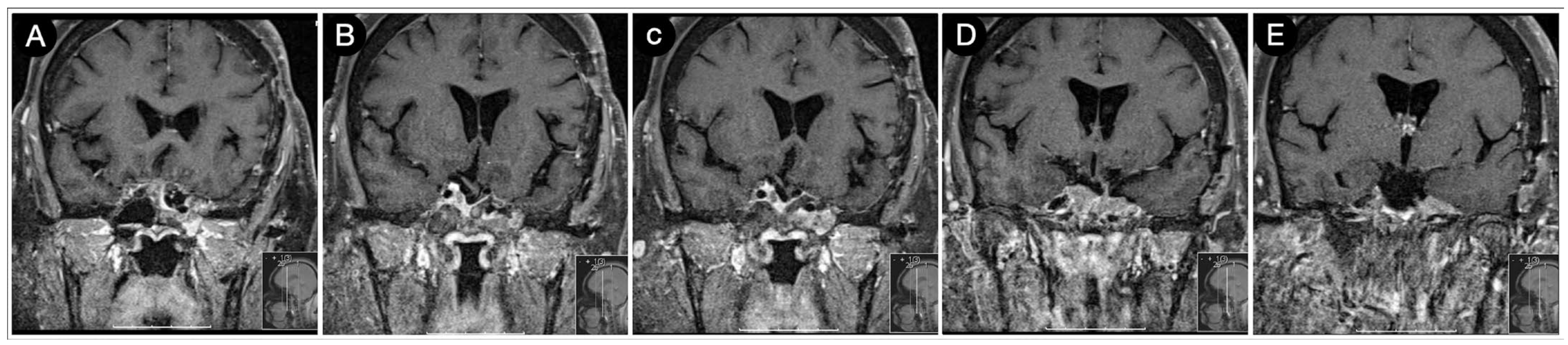 Cancers 15 02235 g021 Cancers 15 02235 g021