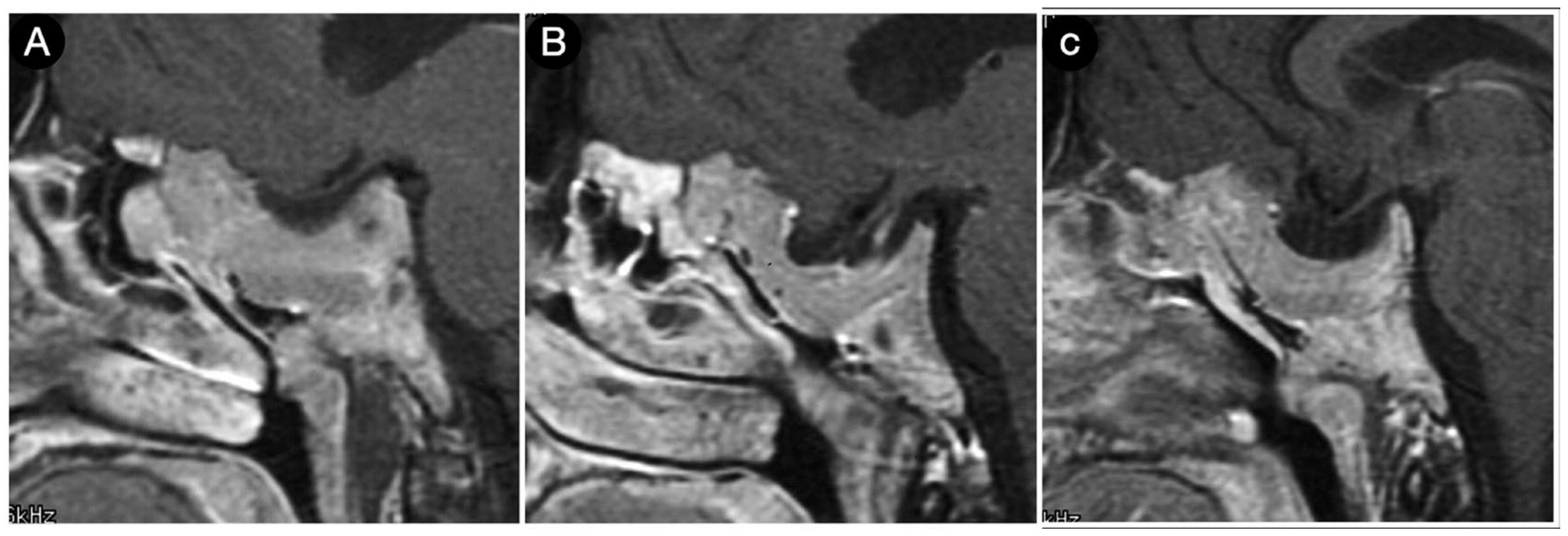 Cancers 15 02235 g023 Cancers 15 02235 g023