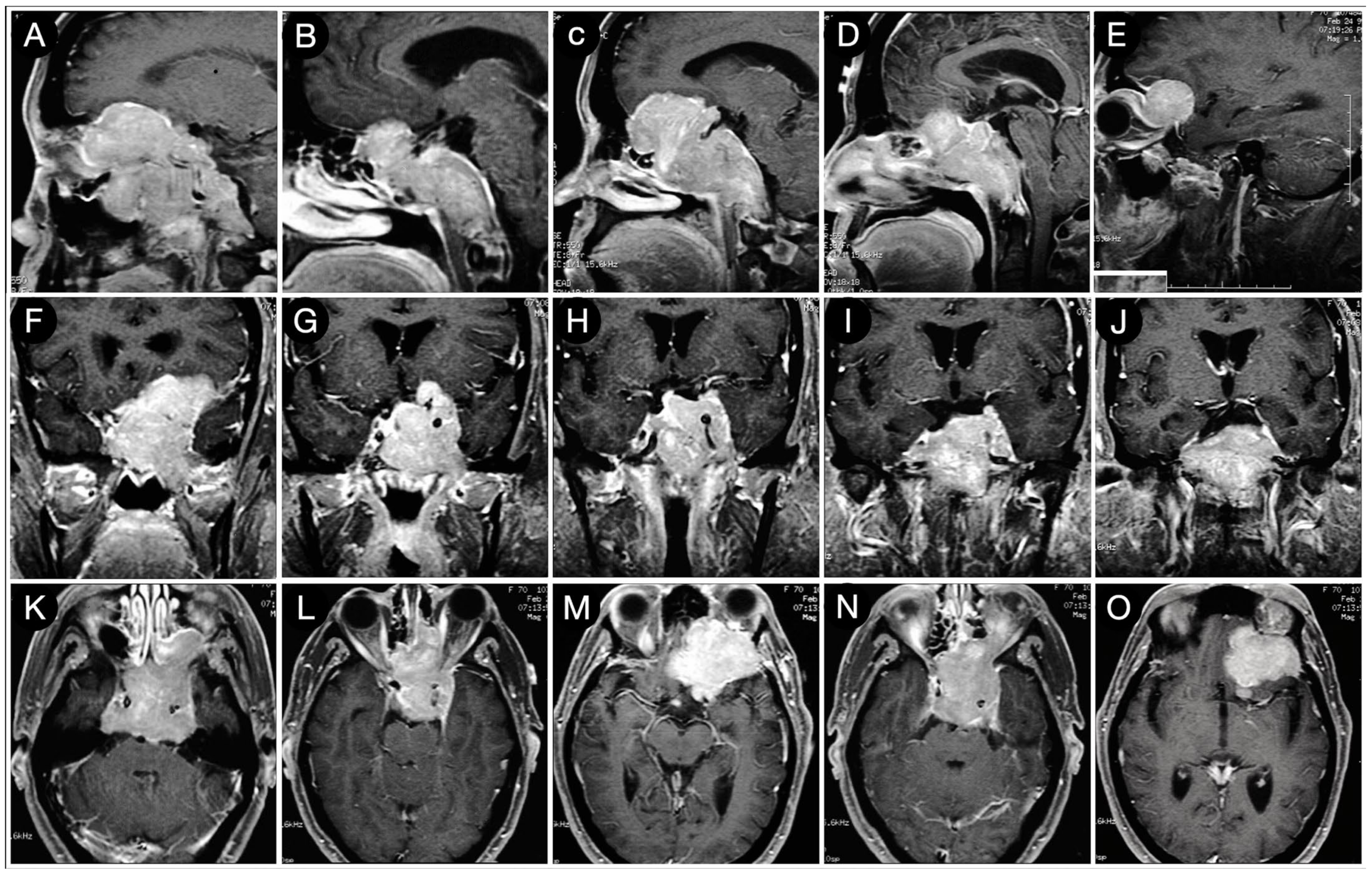 Cancers 15 02235 g024 Cancers 15 02235 g024