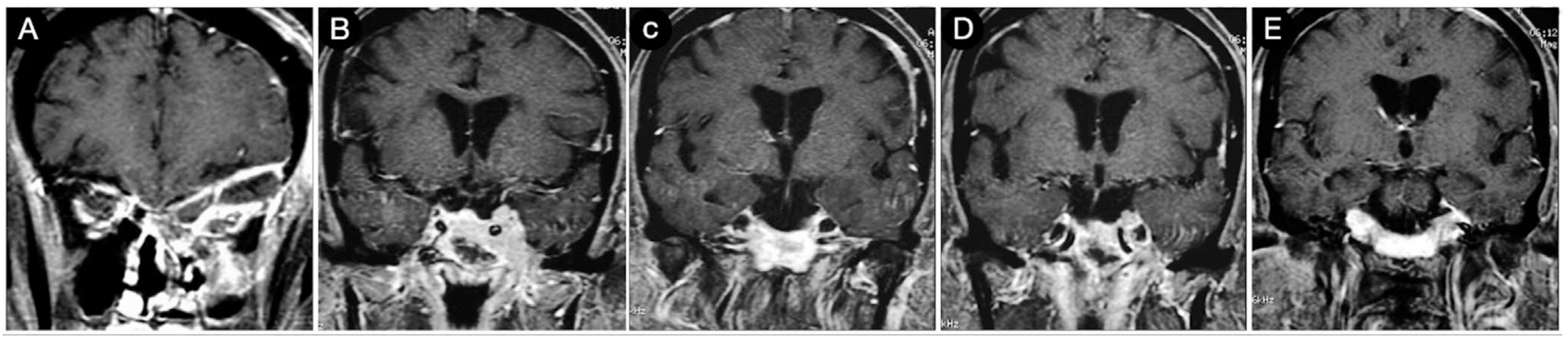 Cancers 15 02235 g025 Cancers 15 02235 g025