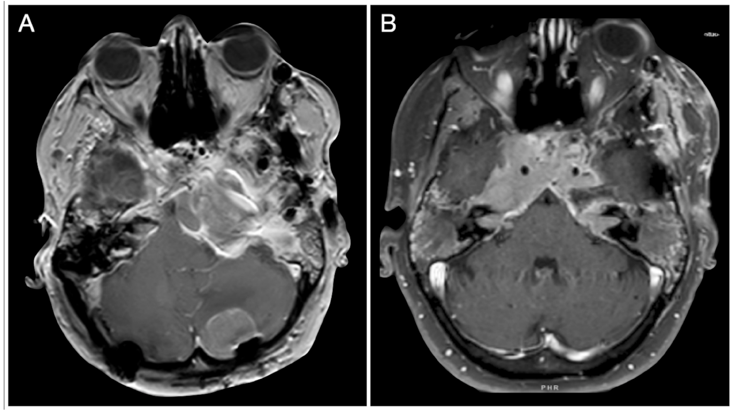 Cancers 15 02235 g026 Cancers 15 02235 g026