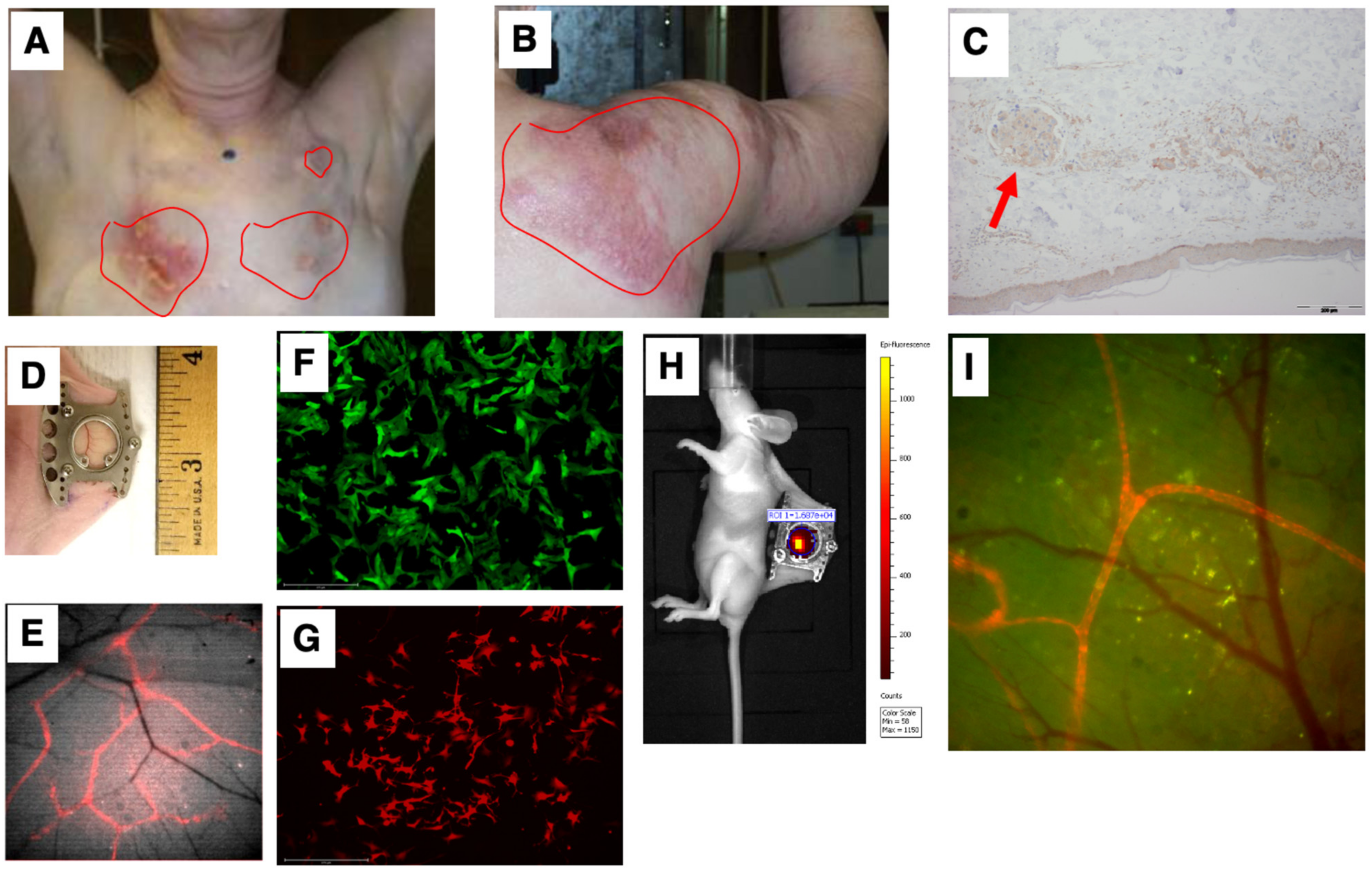 Cancers 15 02261 g003 Cancers 15 02261 g003