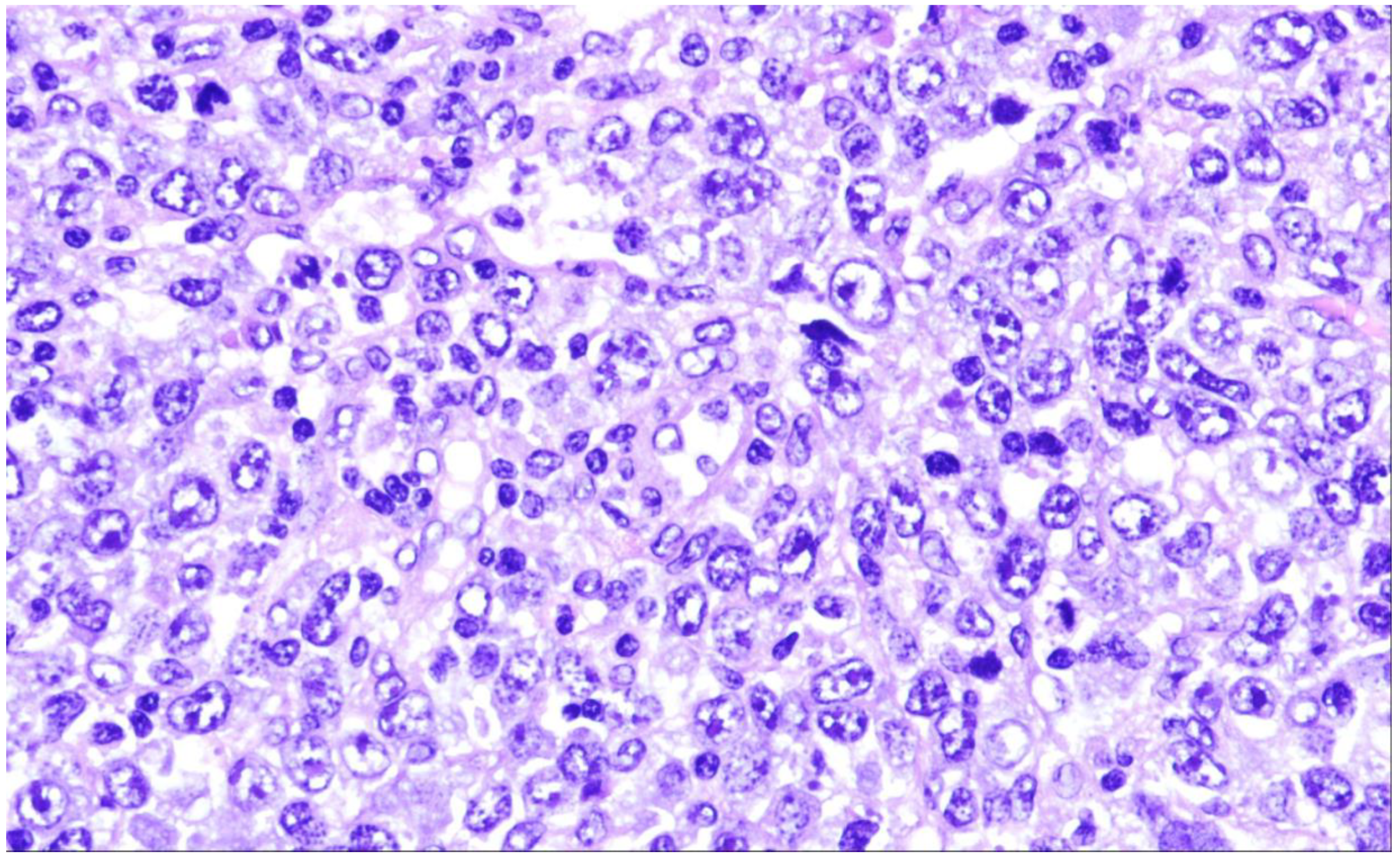 Cancers 15 02285 g001 Cancers 15 02285 g001