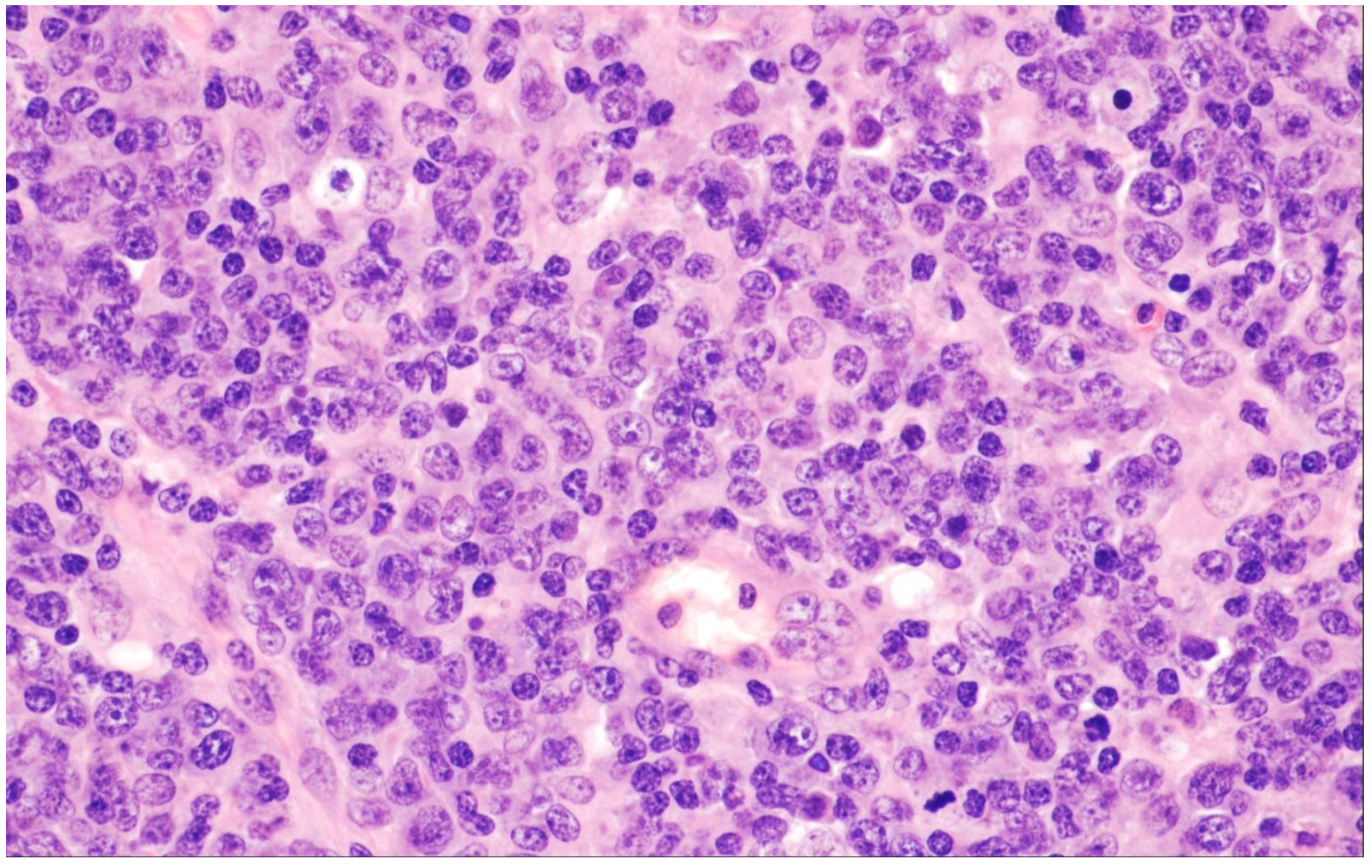 Cancers 15 02285 g003 Cancers 15 02285 g003