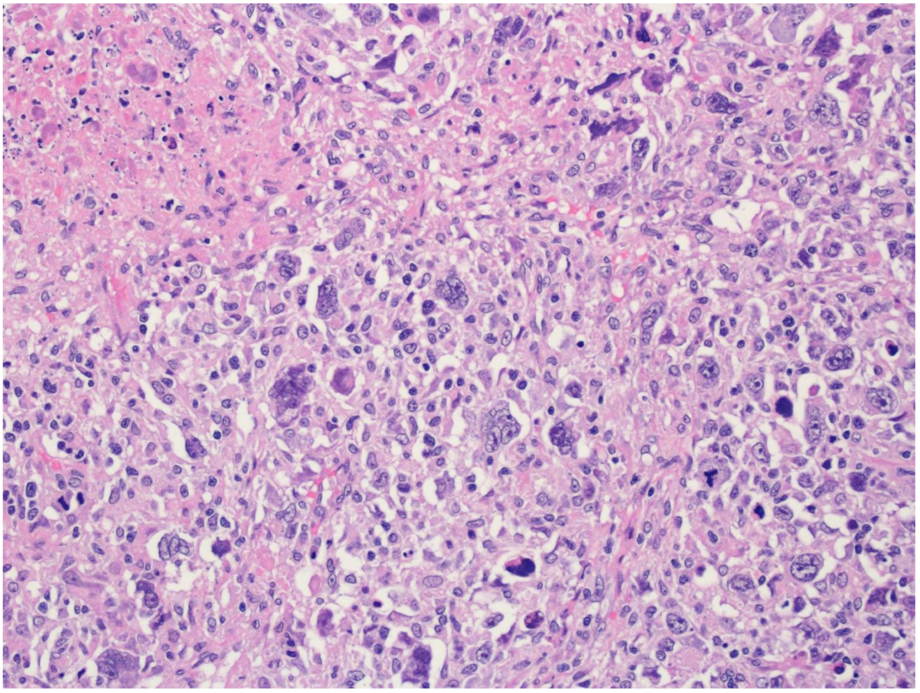 Cancers 15 02285 g007 Cancers 15 02285 g007