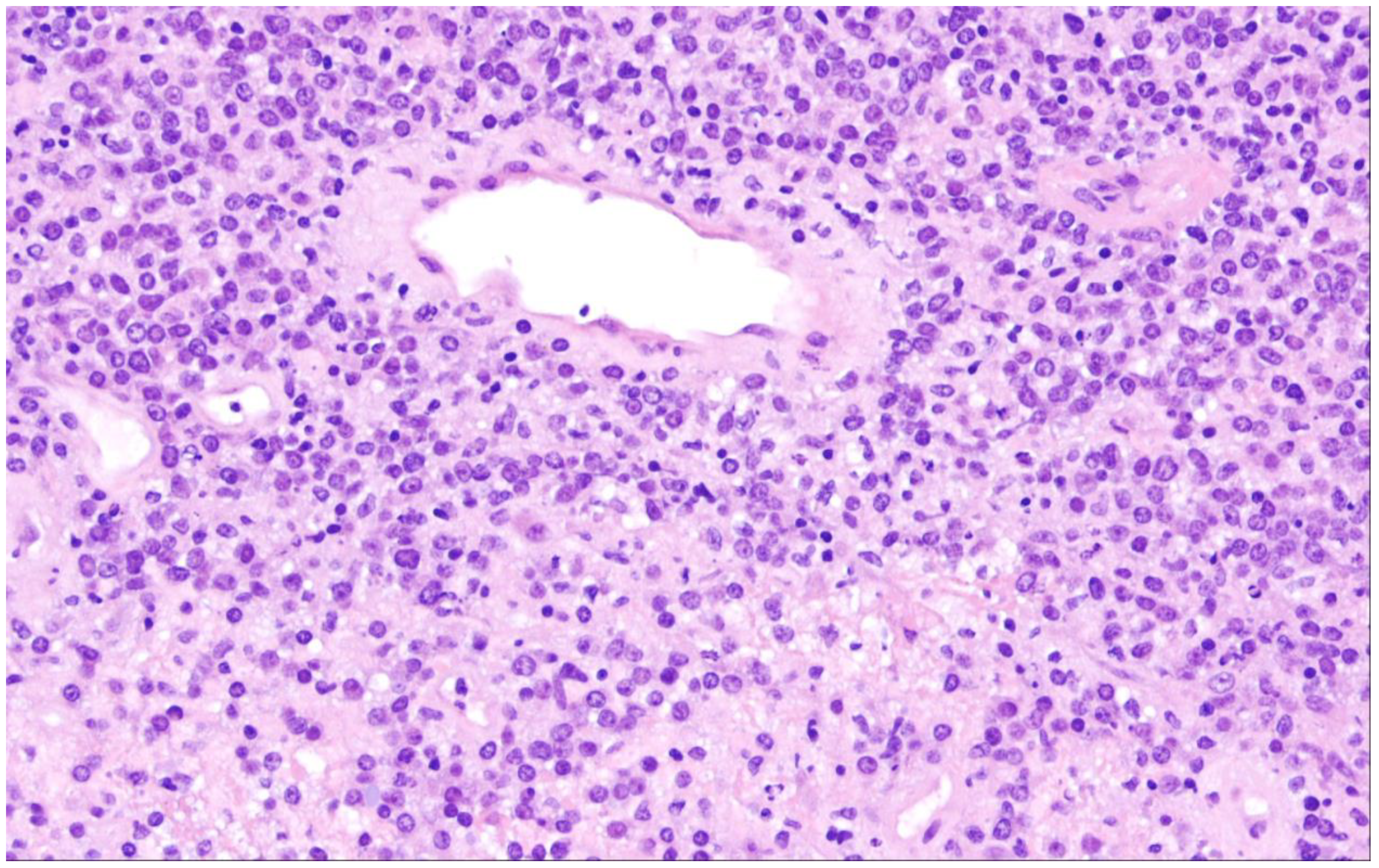 Cancers 15 02285 g011 Cancers 15 02285 g011