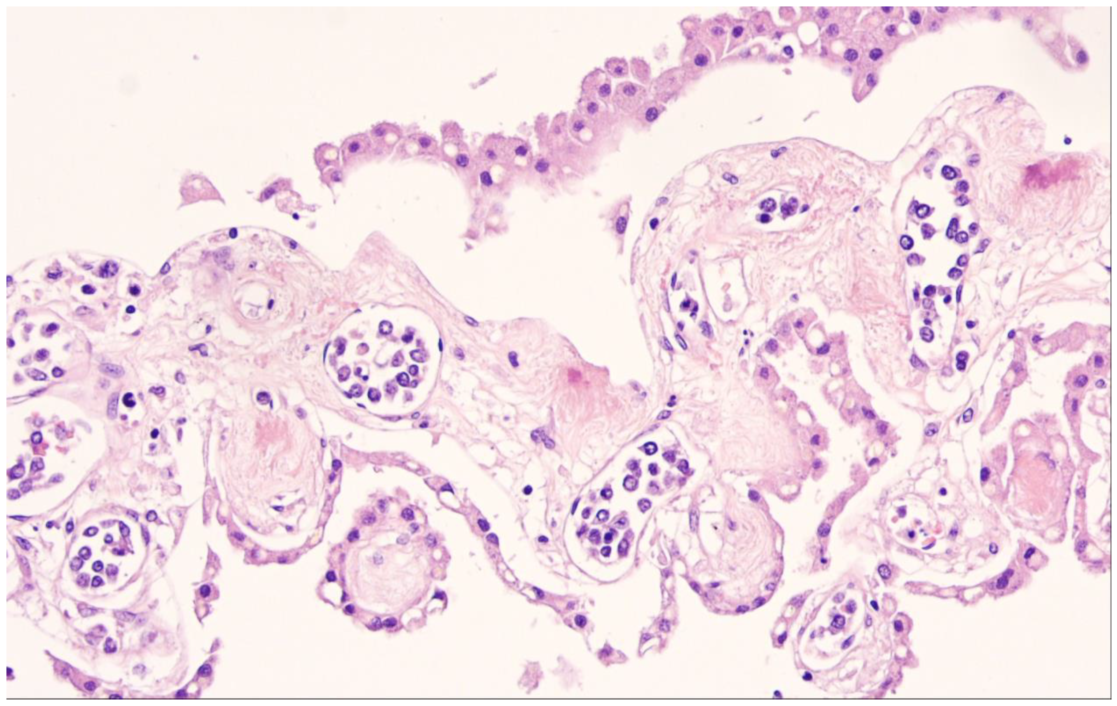 Cancers 15 02285 g013 Cancers 15 02285 g013