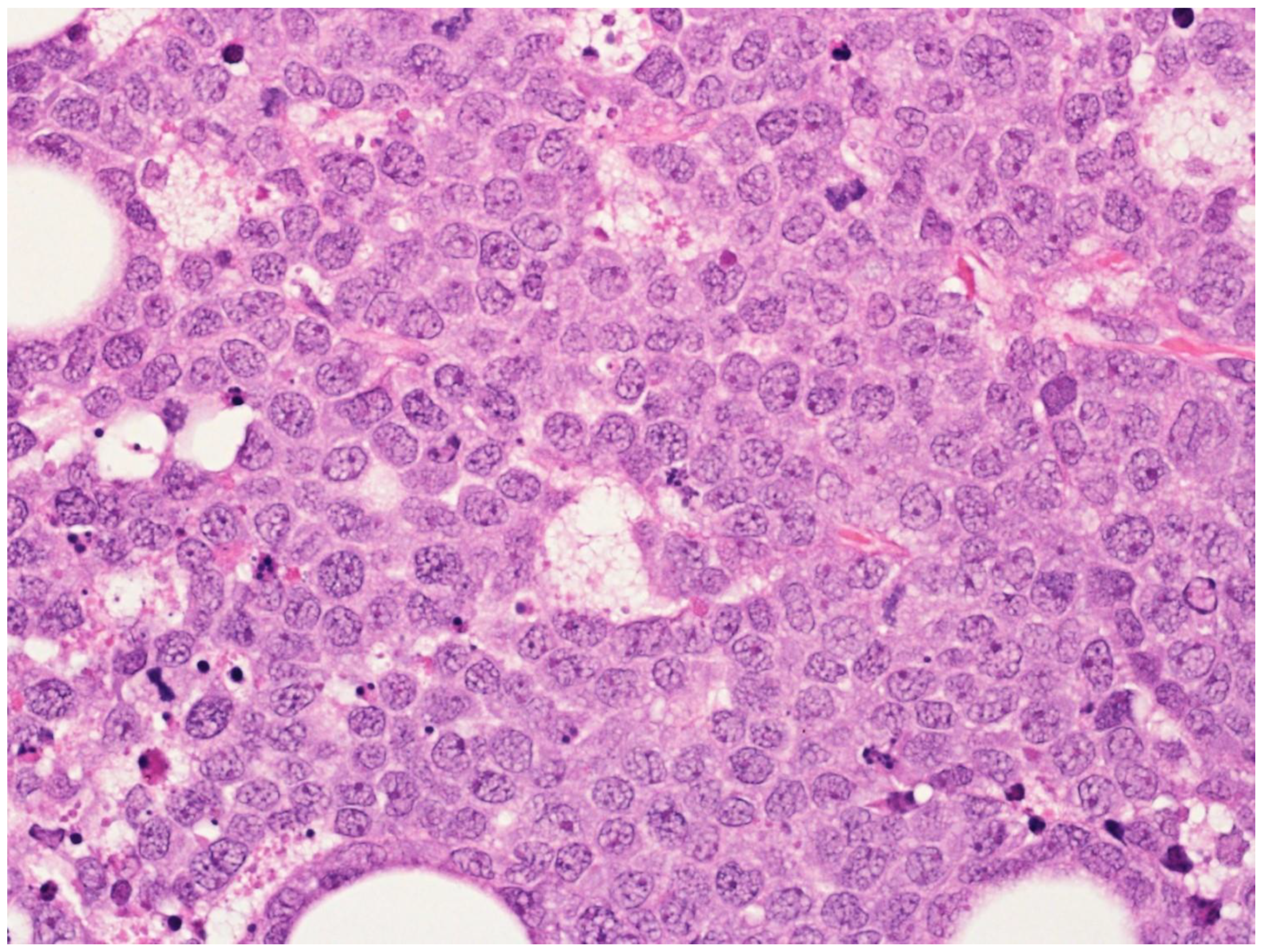 Cancers 15 02285 g015 Cancers 15 02285 g015