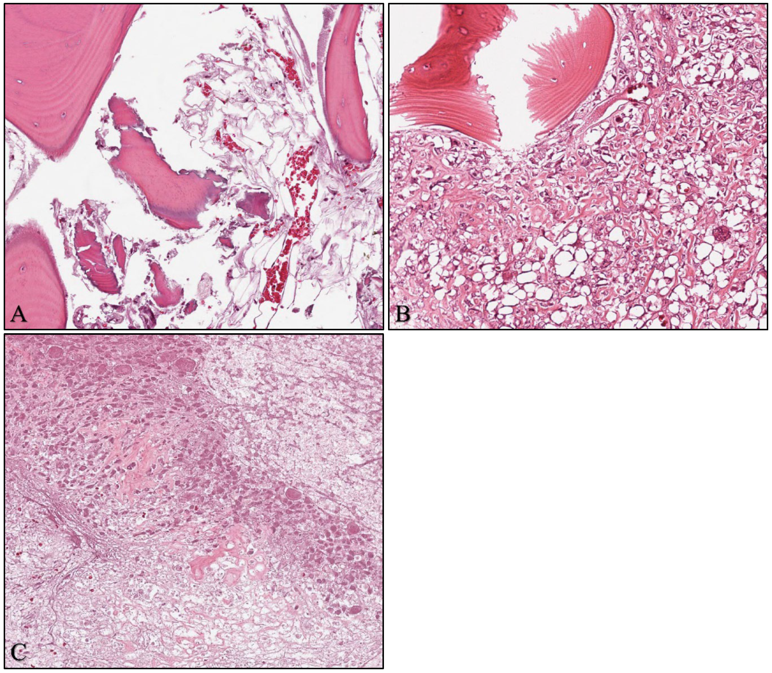 Cancers 15 02290 g001 Cancers 15 02290 g001