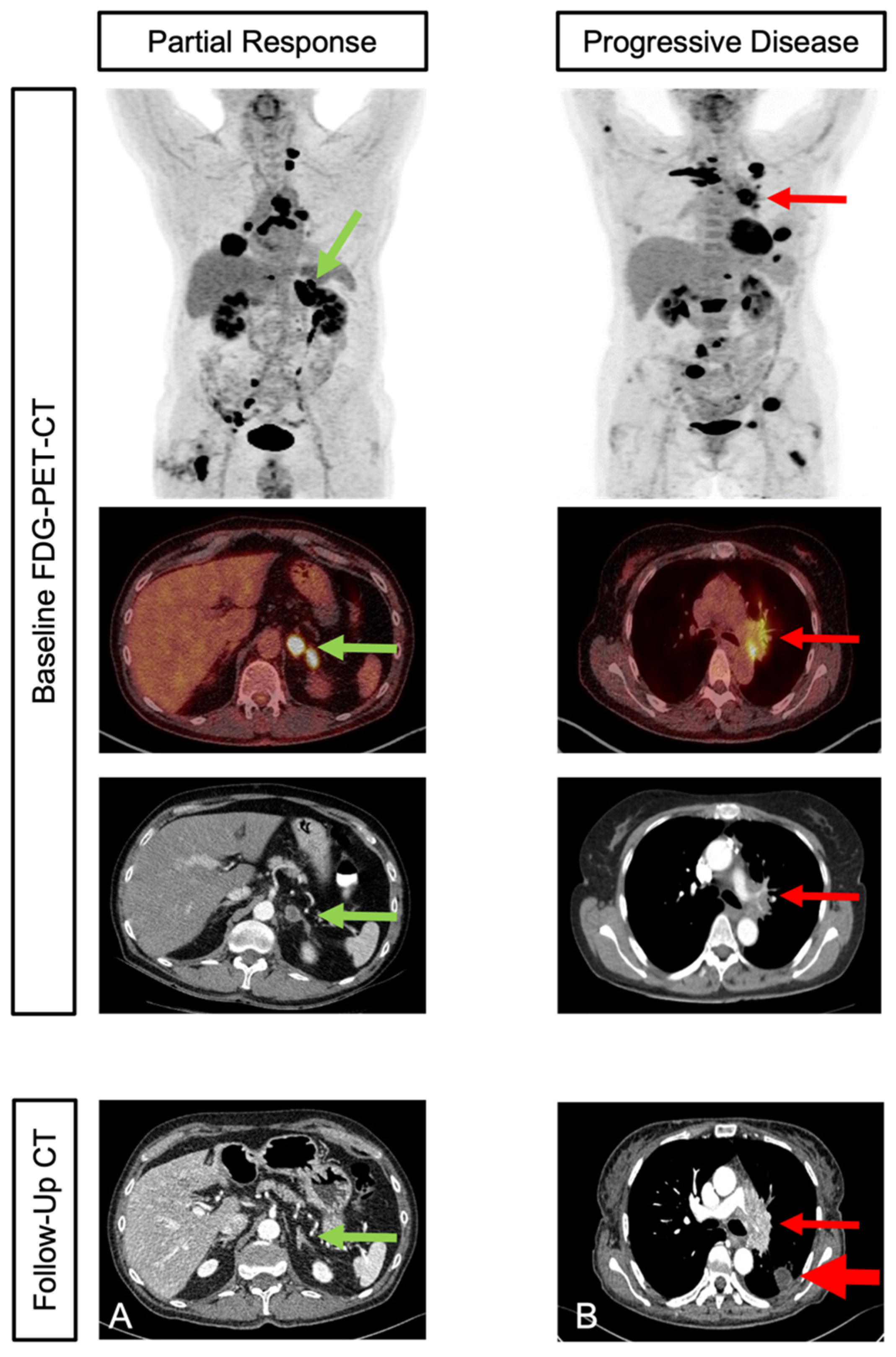 Cancers 15 02297 g002
