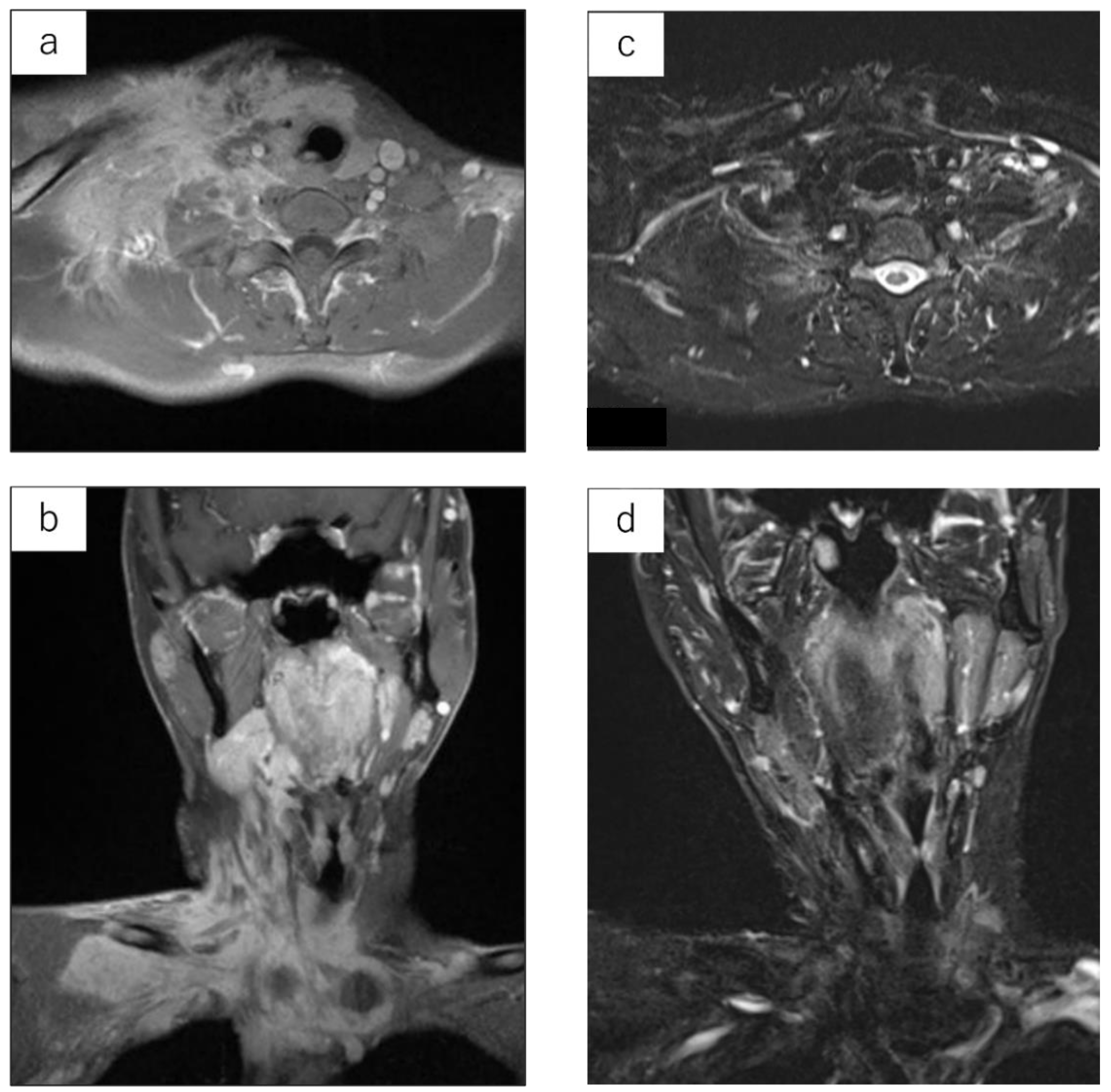 Cancers 15 02314 g002 Cancers 15 02314 g002