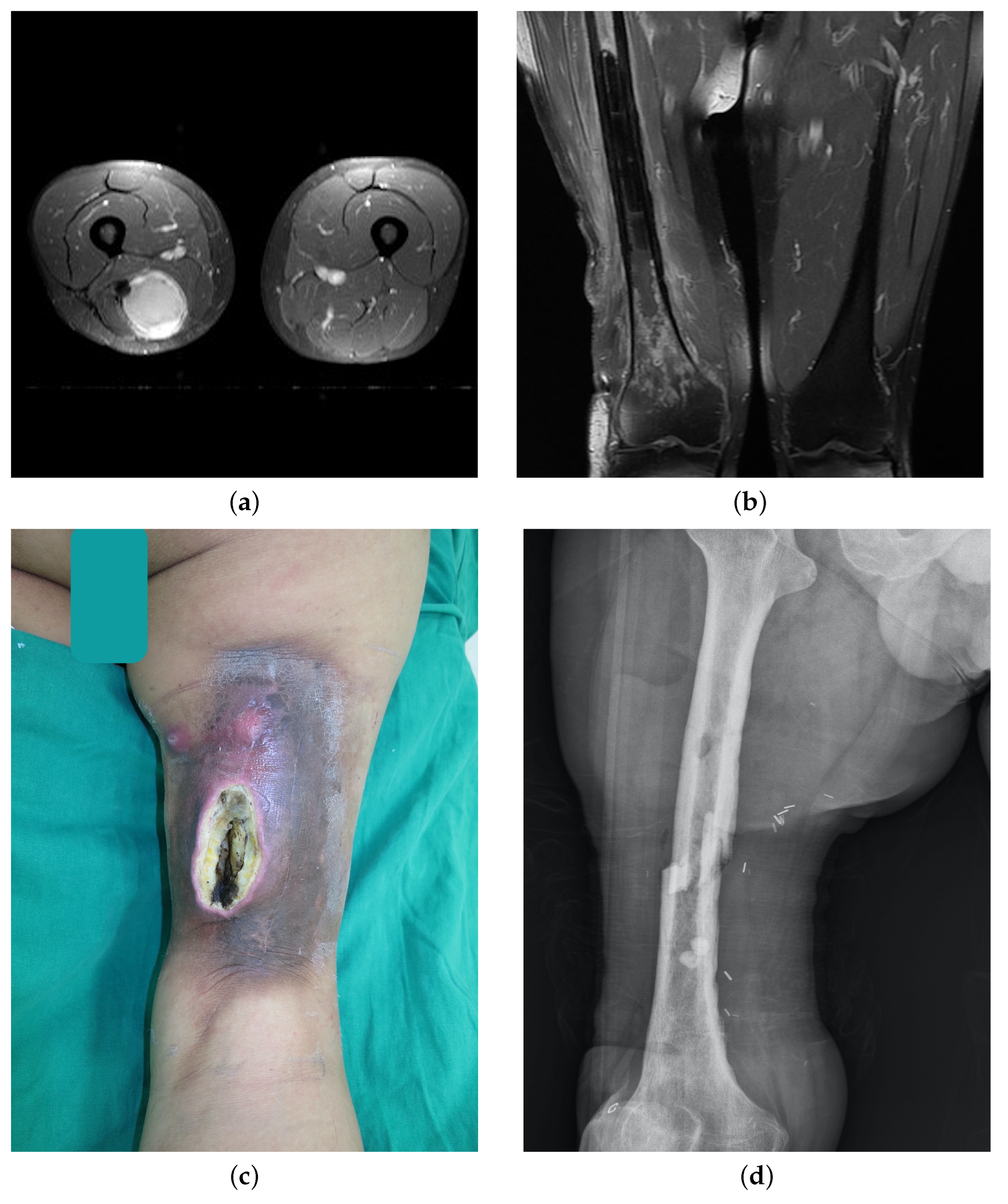 Cancers 15 02339 g004