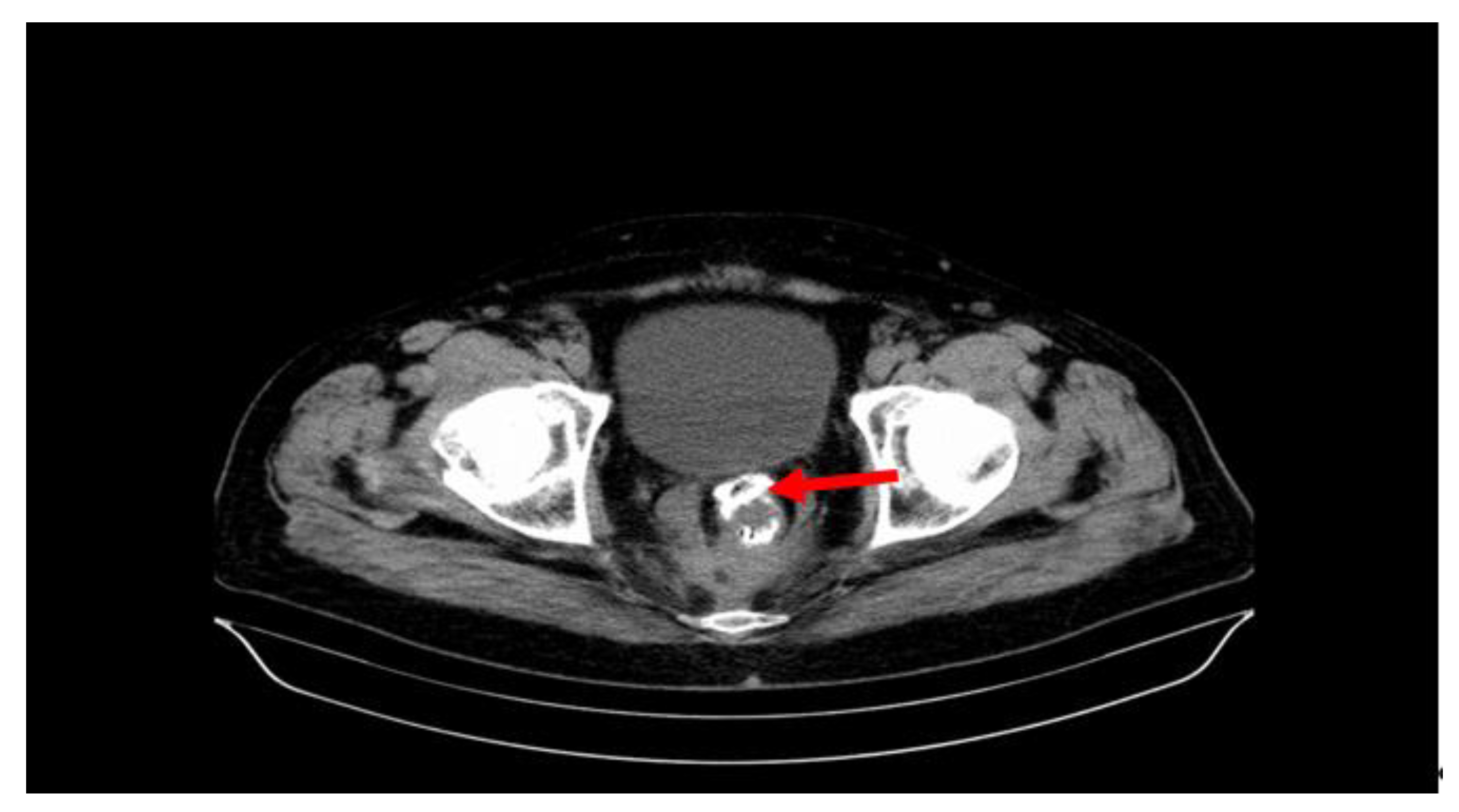 Cancers 15 02340 g001