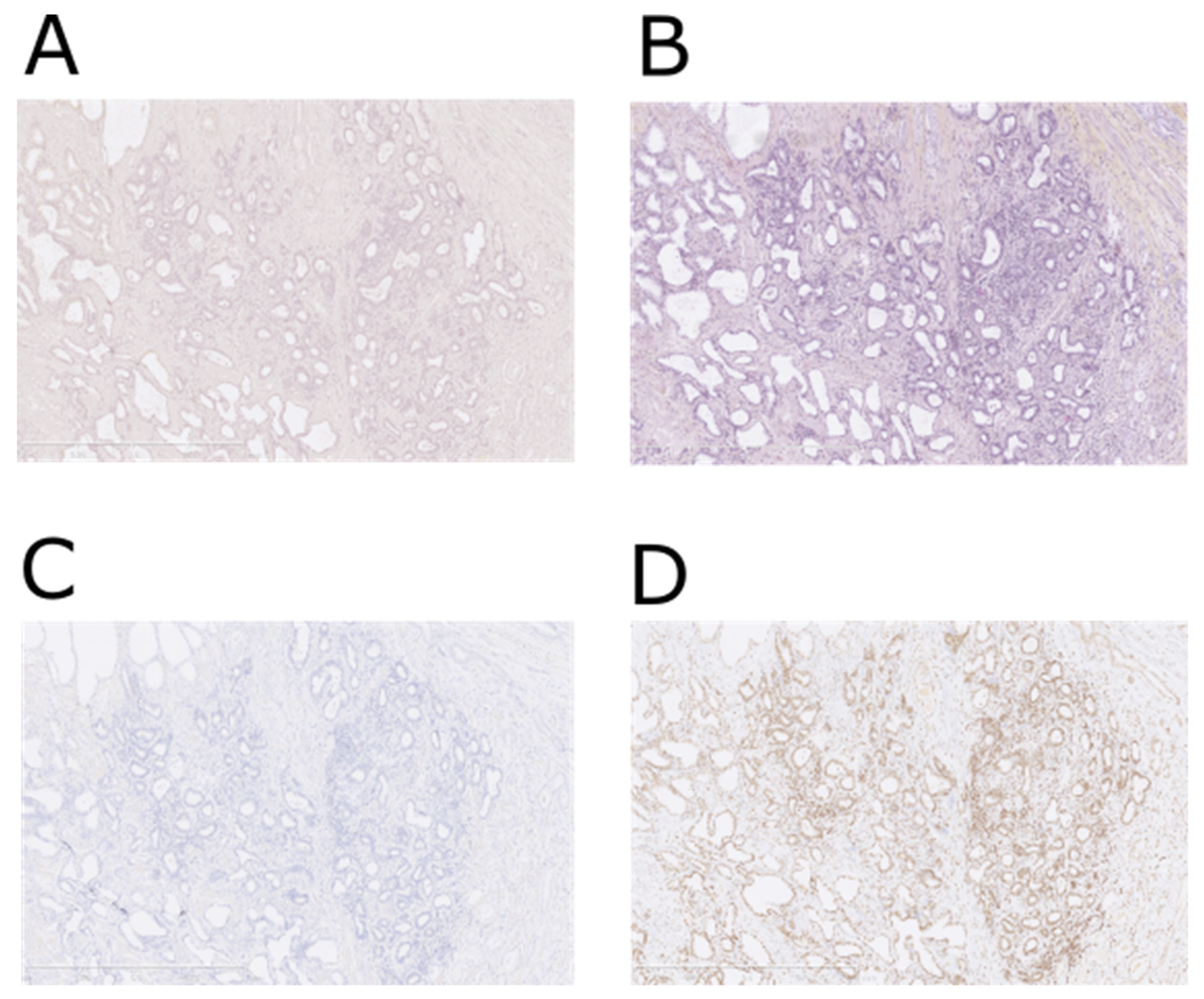 Cancers 15 02345 g001