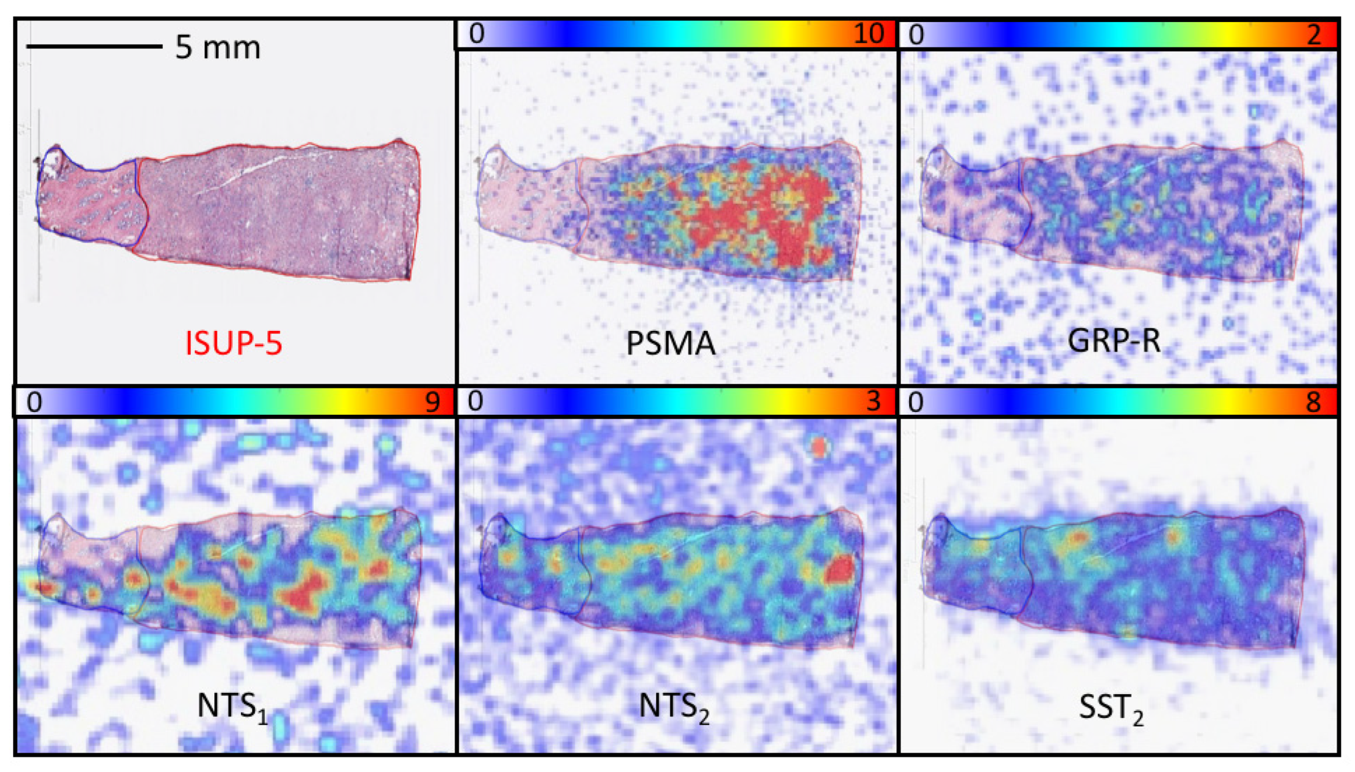 Cancers 15 02345 g003