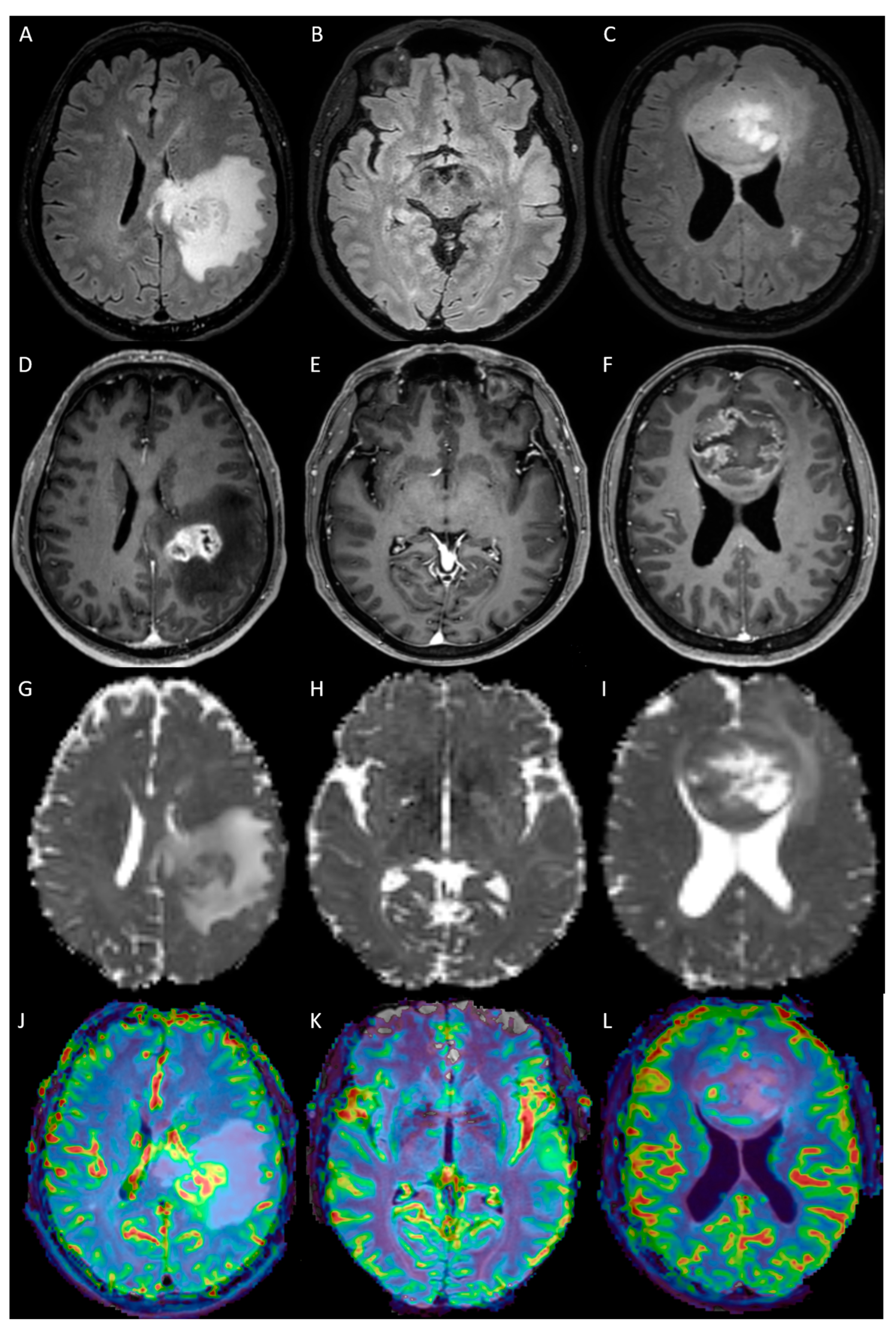 Cancers 15 02355 g003 Cancers 15 02355 g003