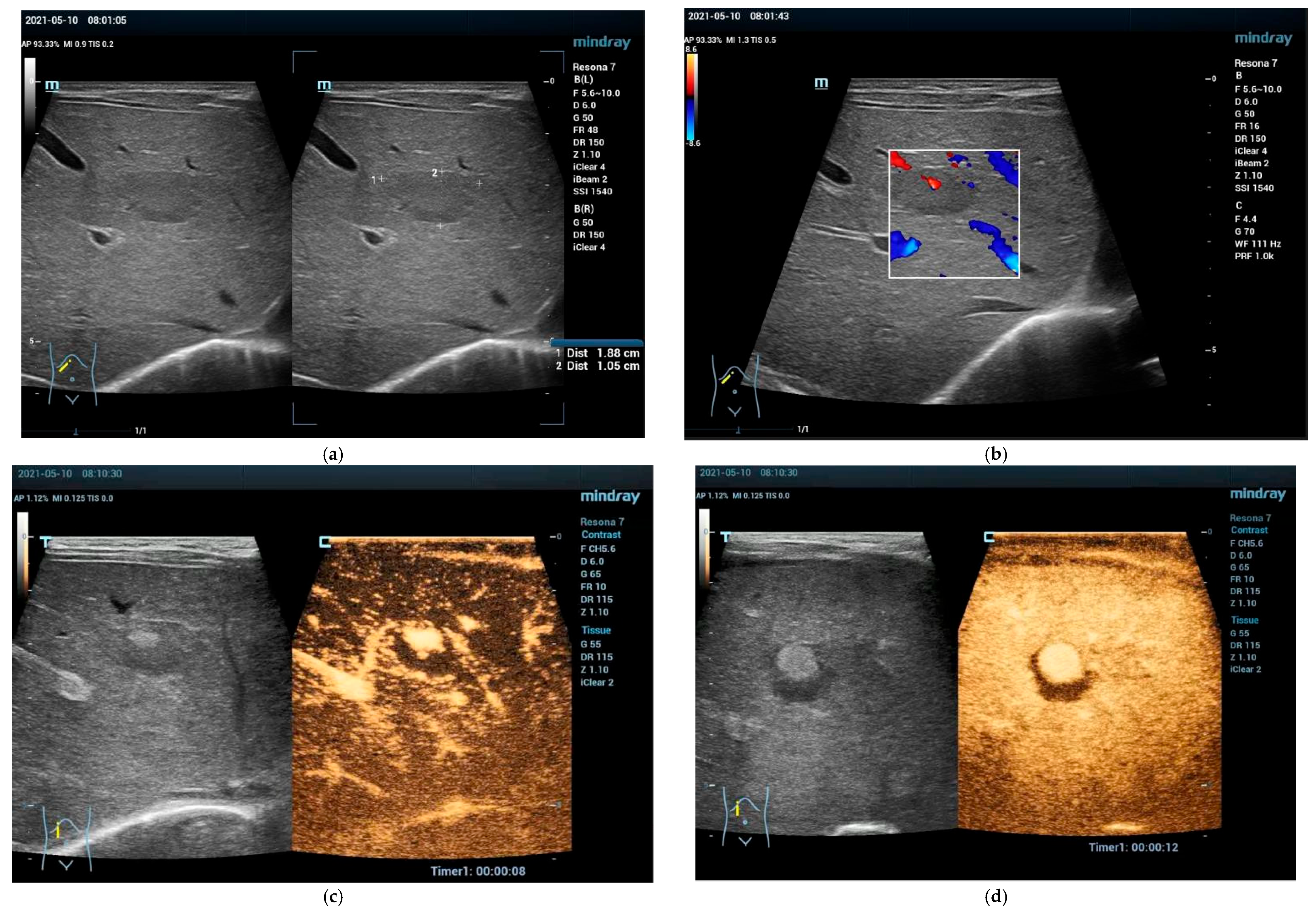 Cancers 15 02360 g001a