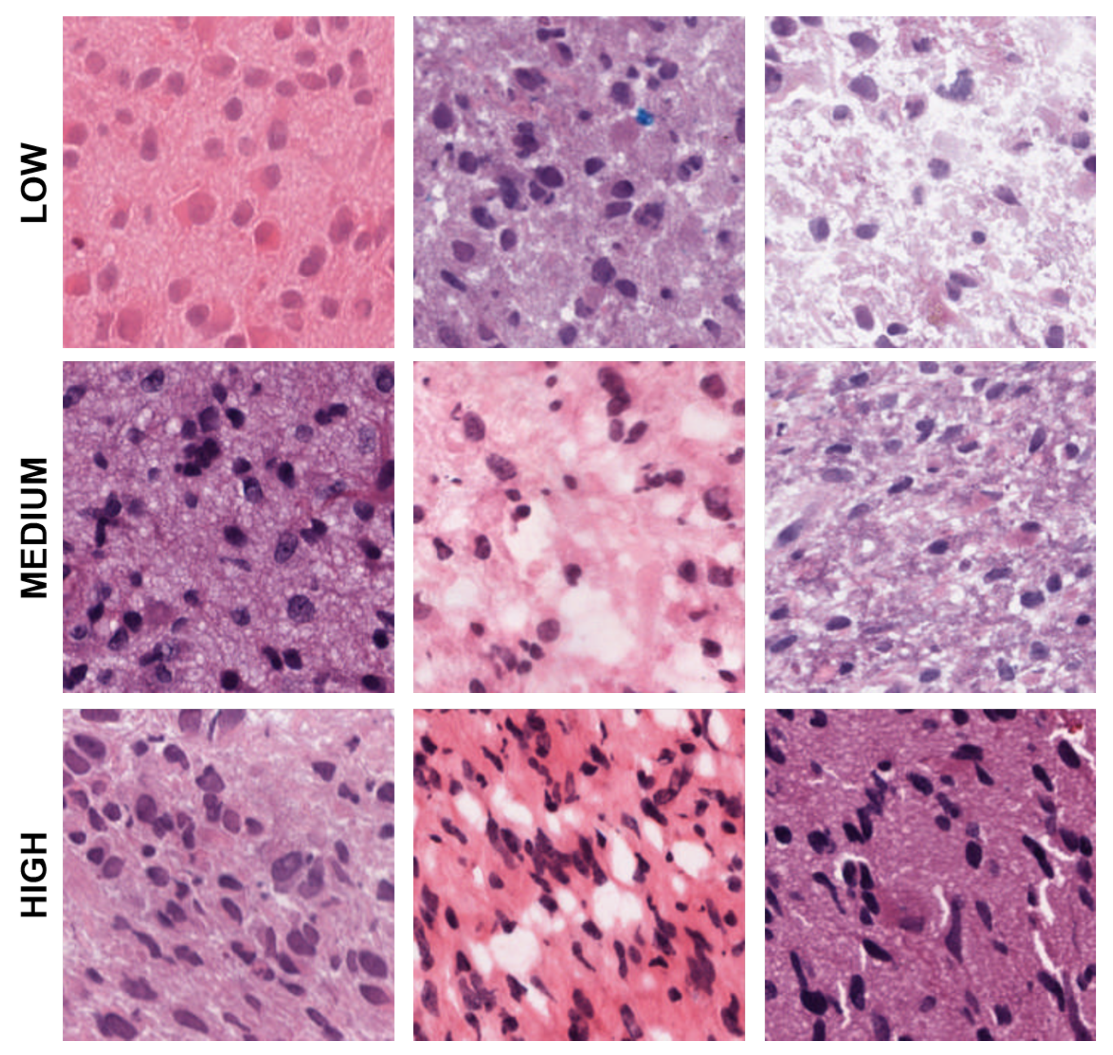 Cancers 15 02387 g004