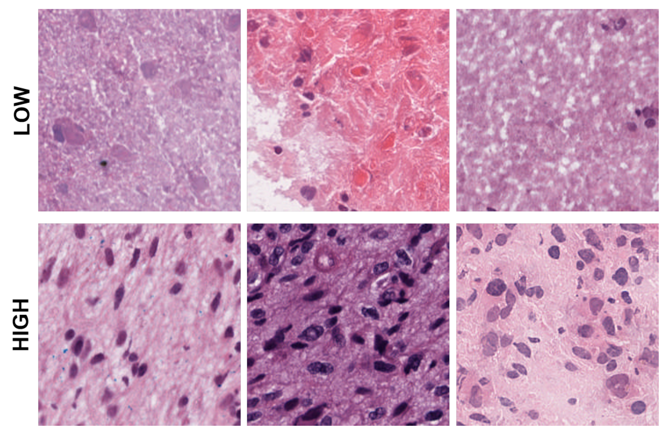 Cancers 15 02387 g005