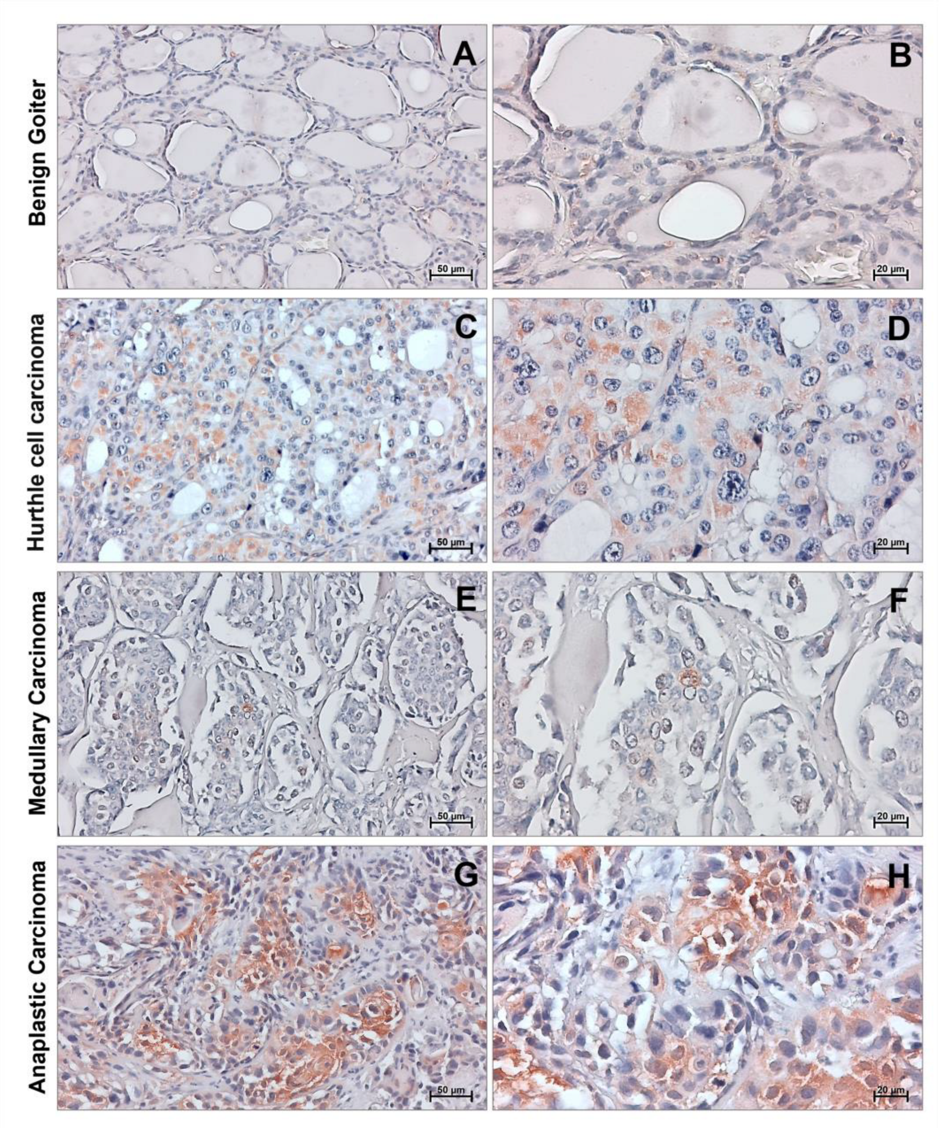 Cancers 15 02403 g002 Cancers 15 02403 g002