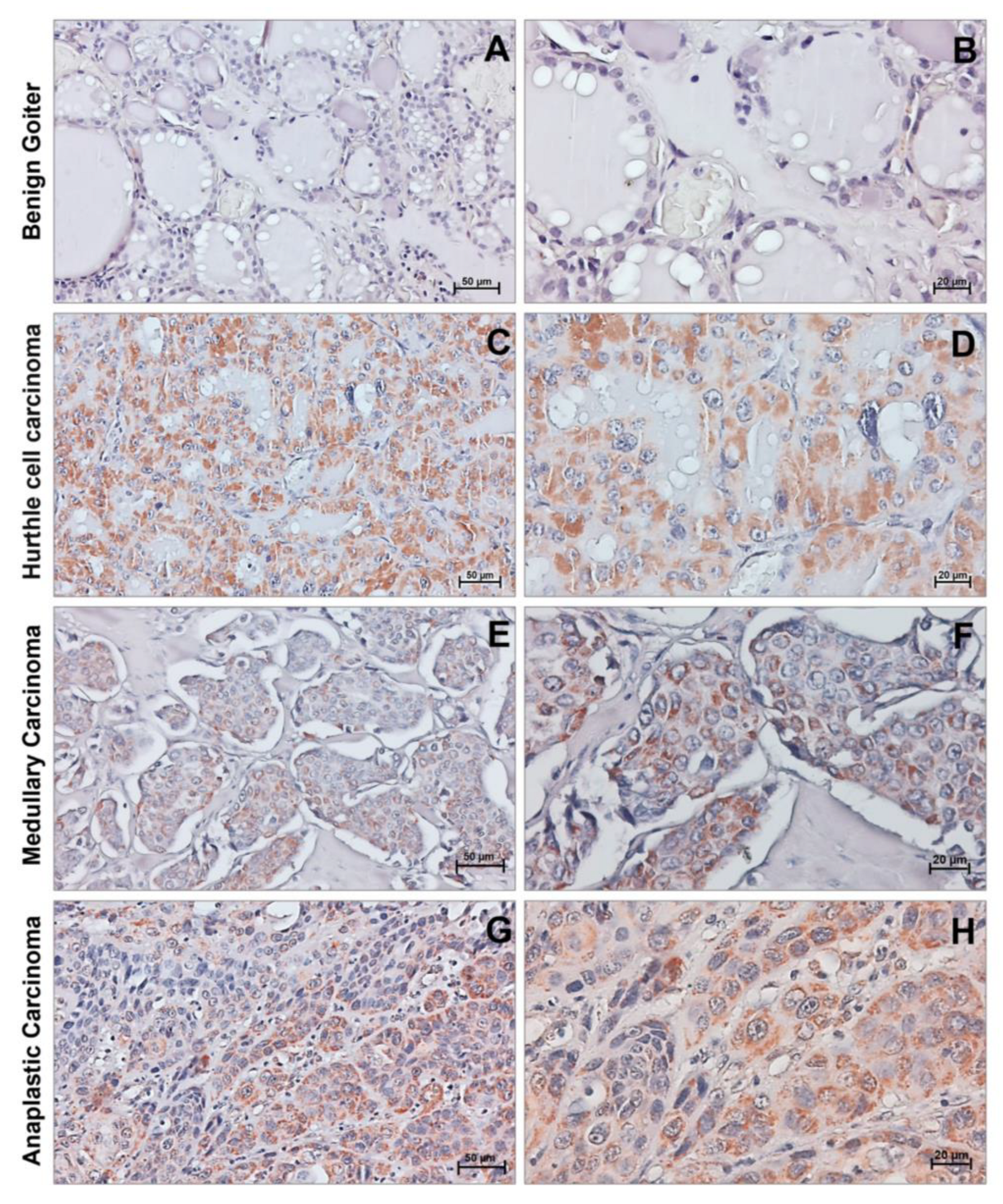 Cancers 15 02403 g004 Cancers 15 02403 g004