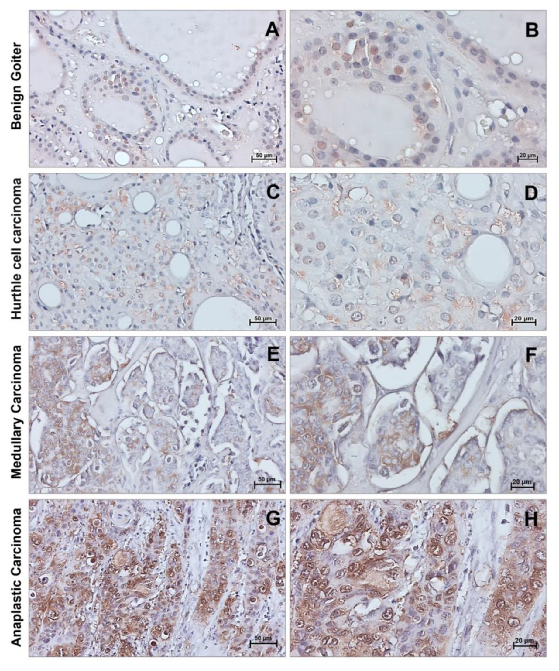 Cancers 15 02403 g006 Cancers 15 02403 g006