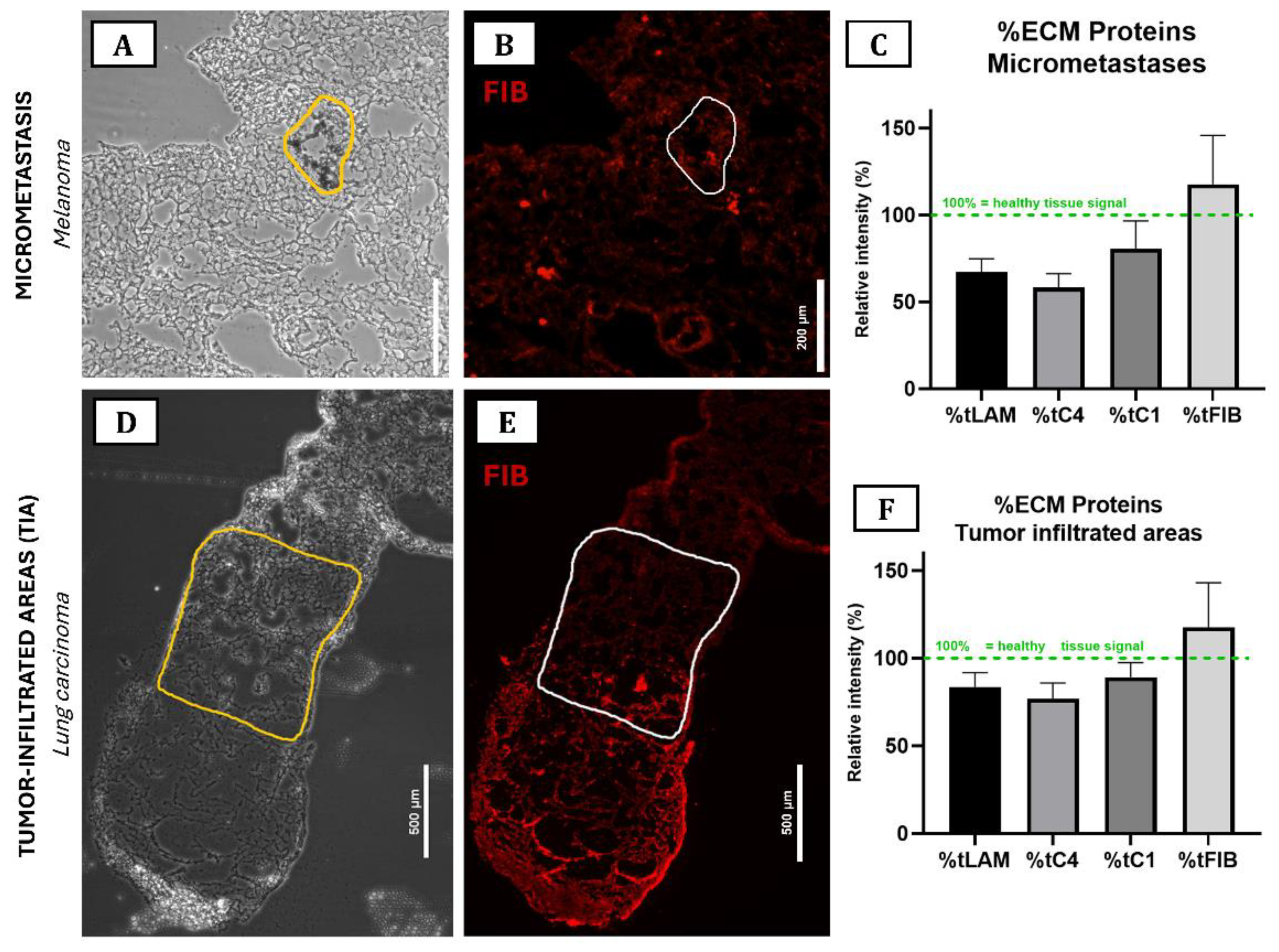 Cancers 15 02404 g005