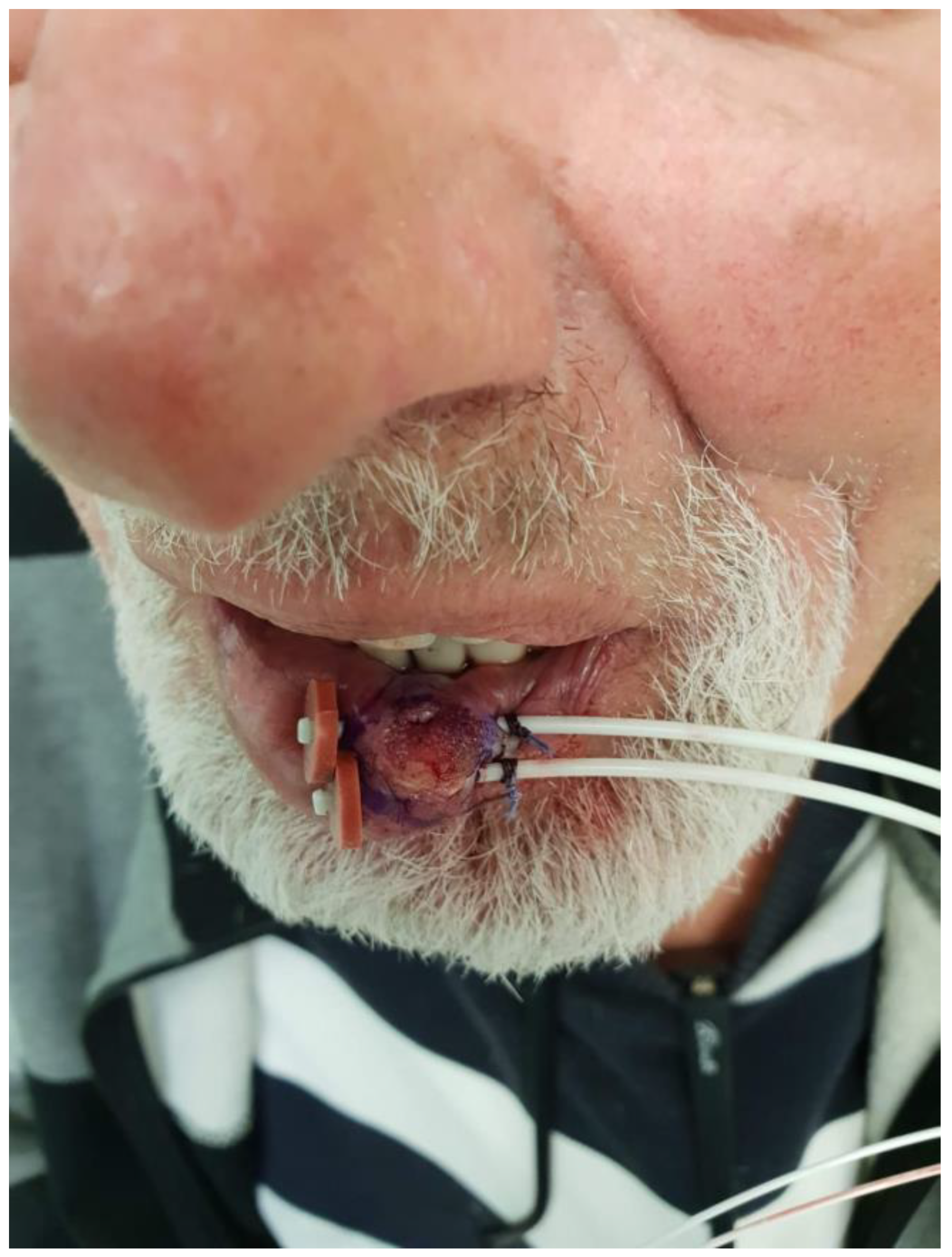 Cancers 15 02408 g005