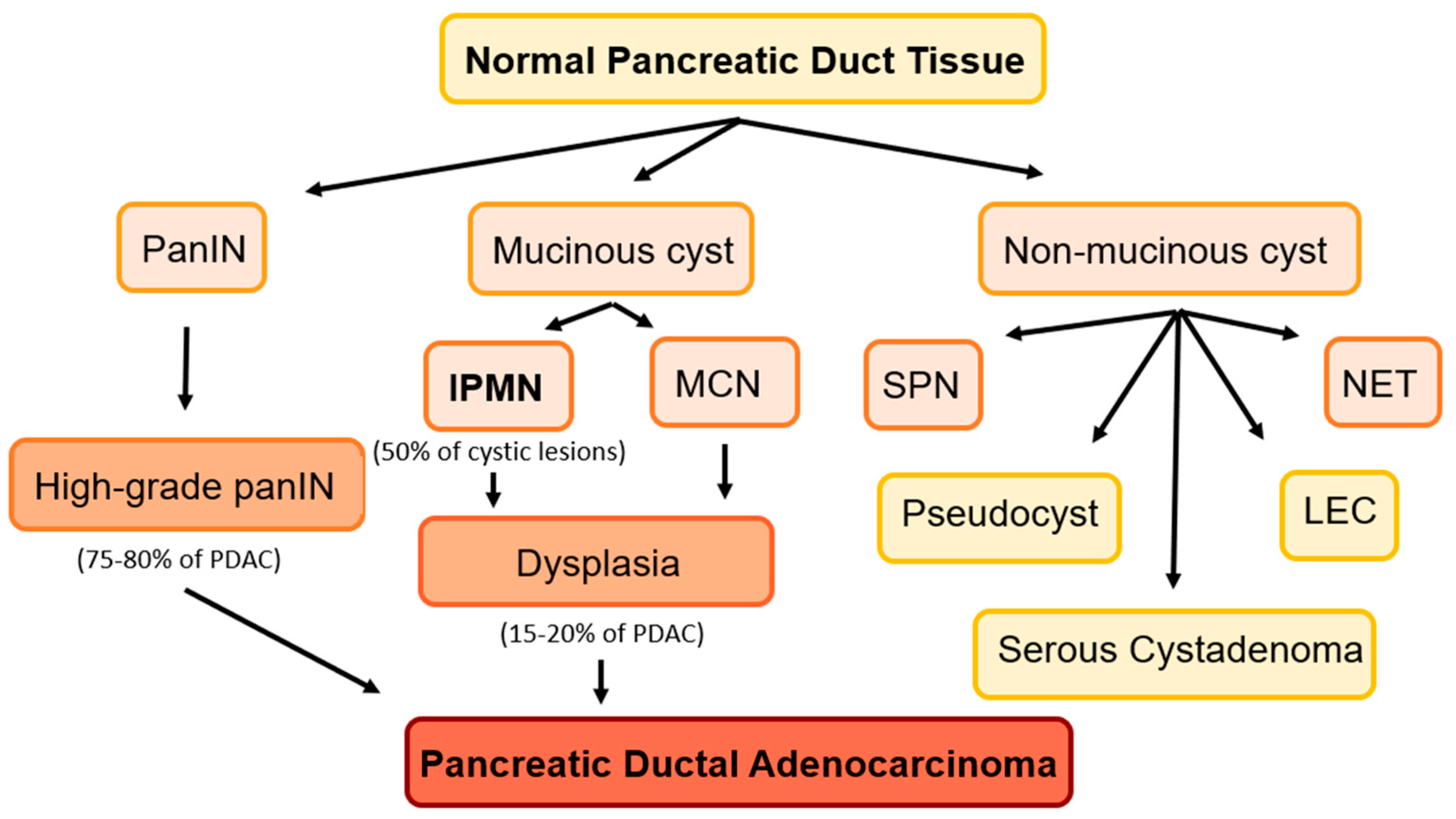 Pancreatic pseudocyst diagram