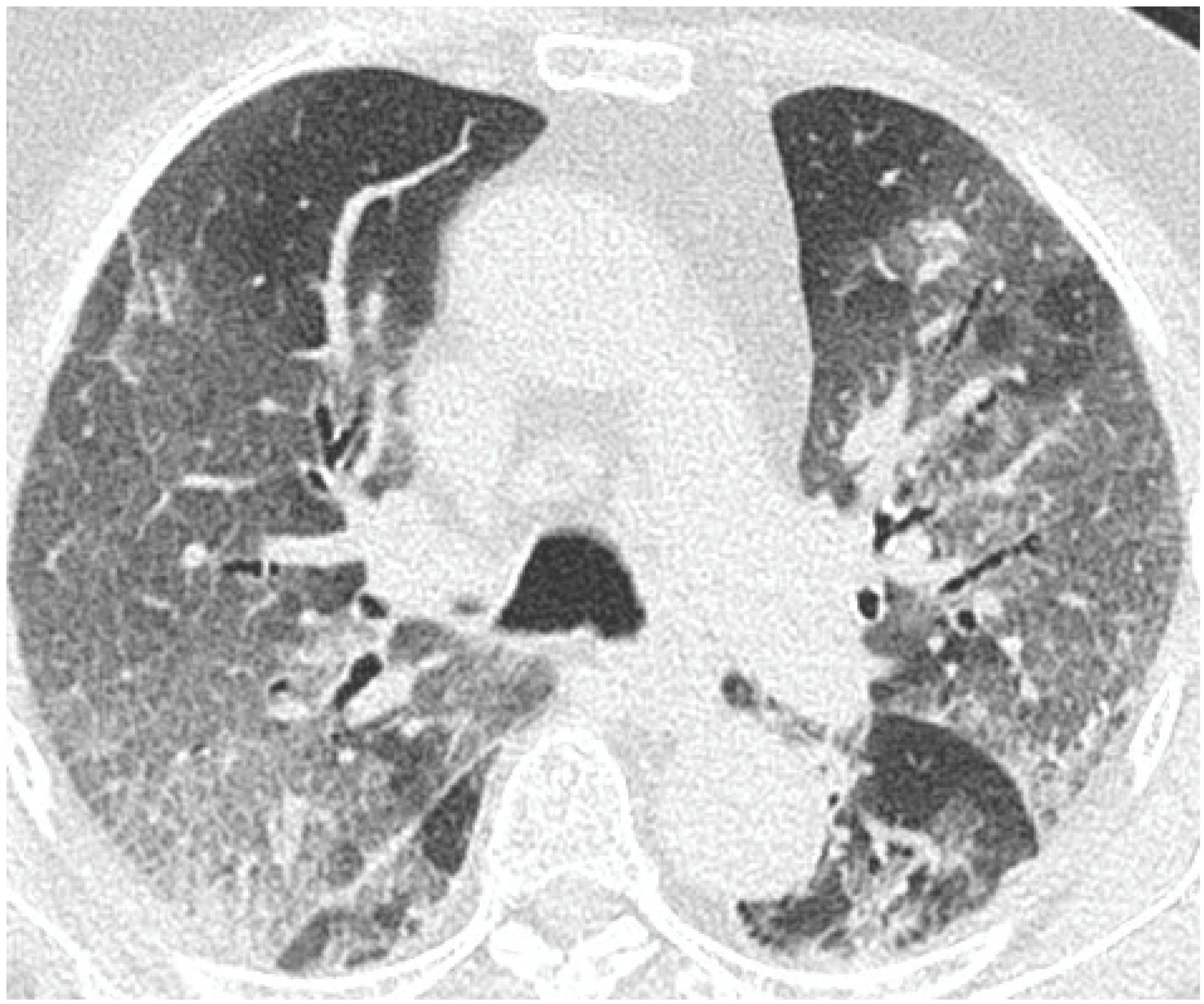 Cancers 15 02417 g020