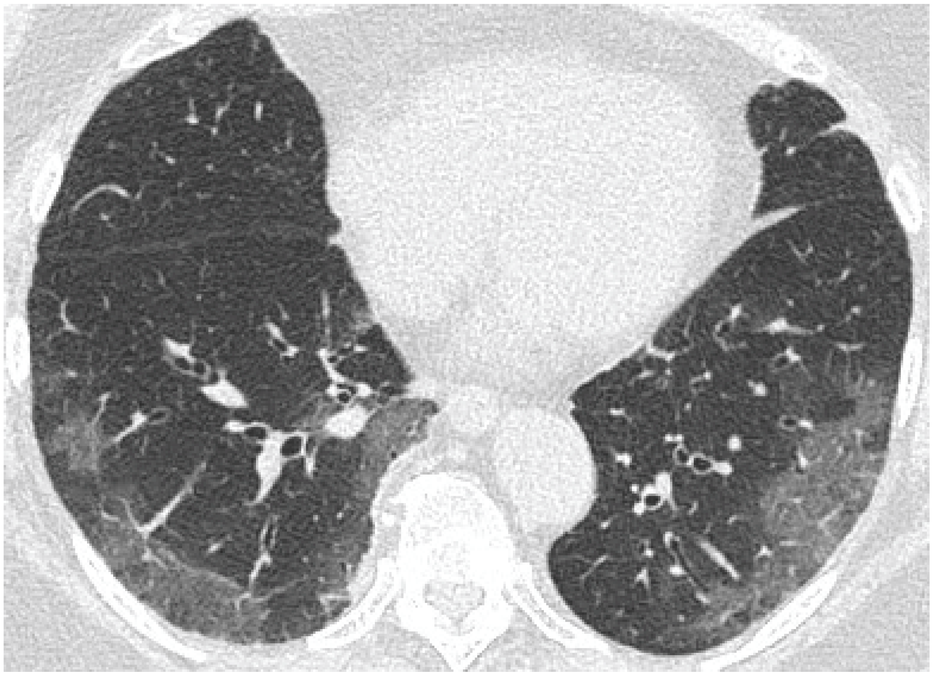 Cancers 15 02417 g021