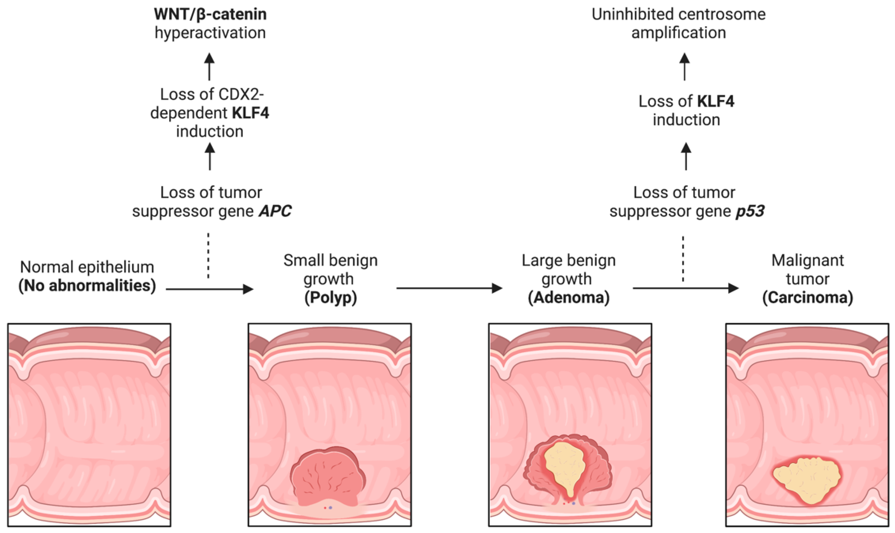 Cancers 15 02430 g002