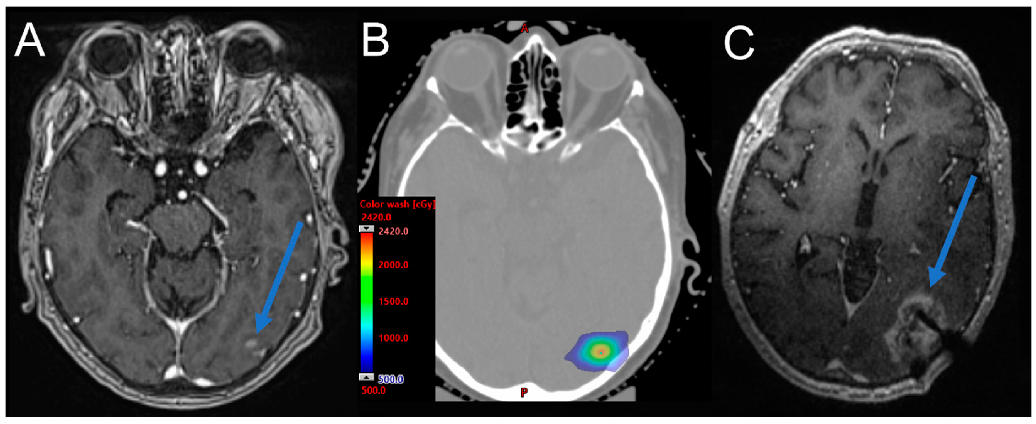 Cancers 15 02432 g003 Cancers 15 02432 g003