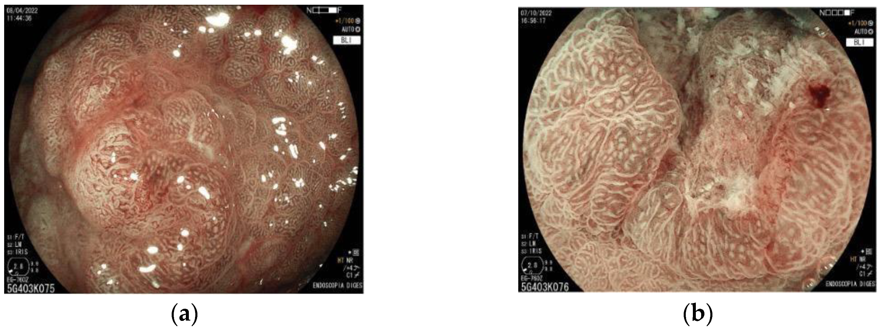 Cancers 15 02445 g007 Cancers 15 02445 g007