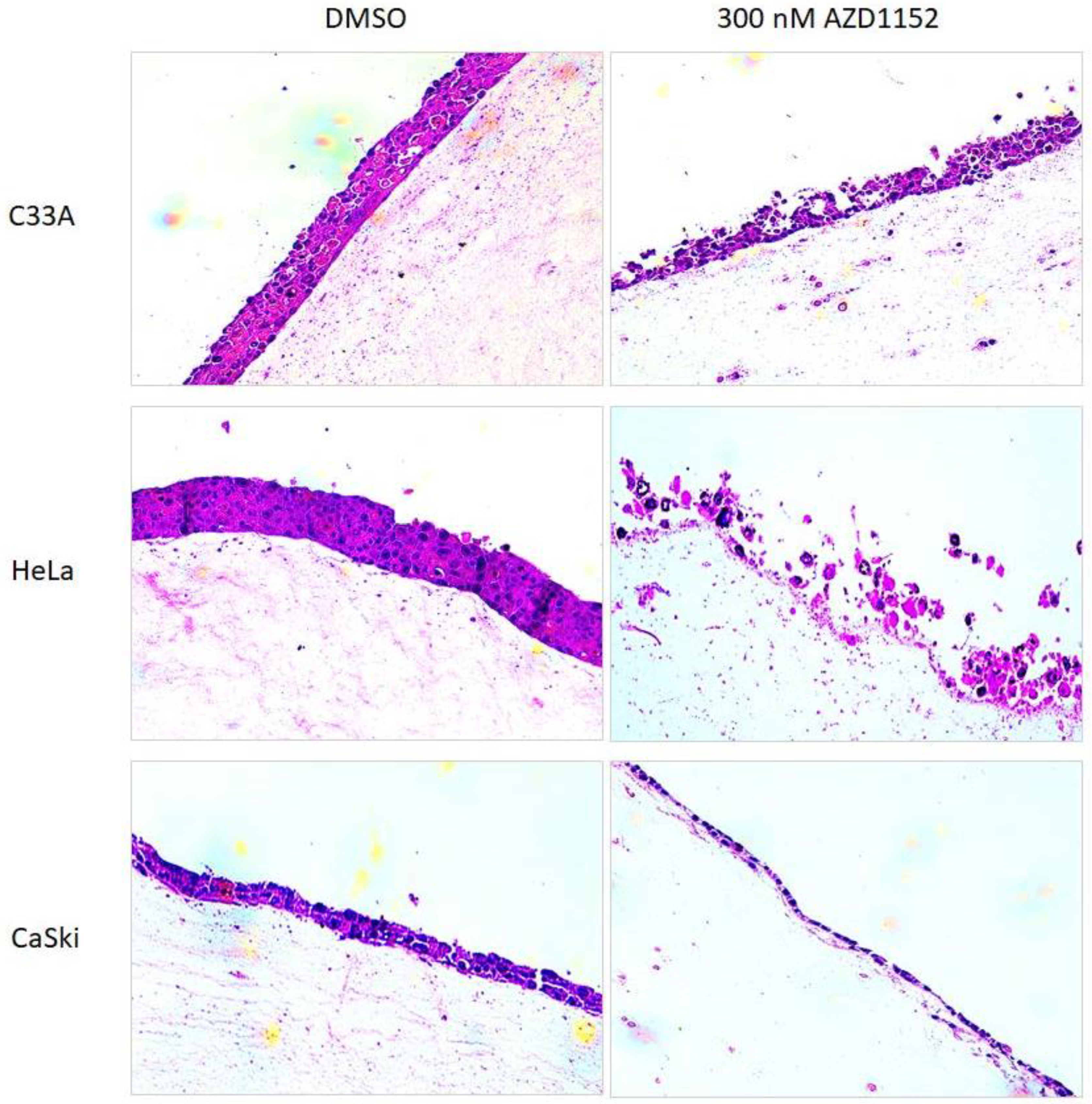 Cancers 15 02465 g004