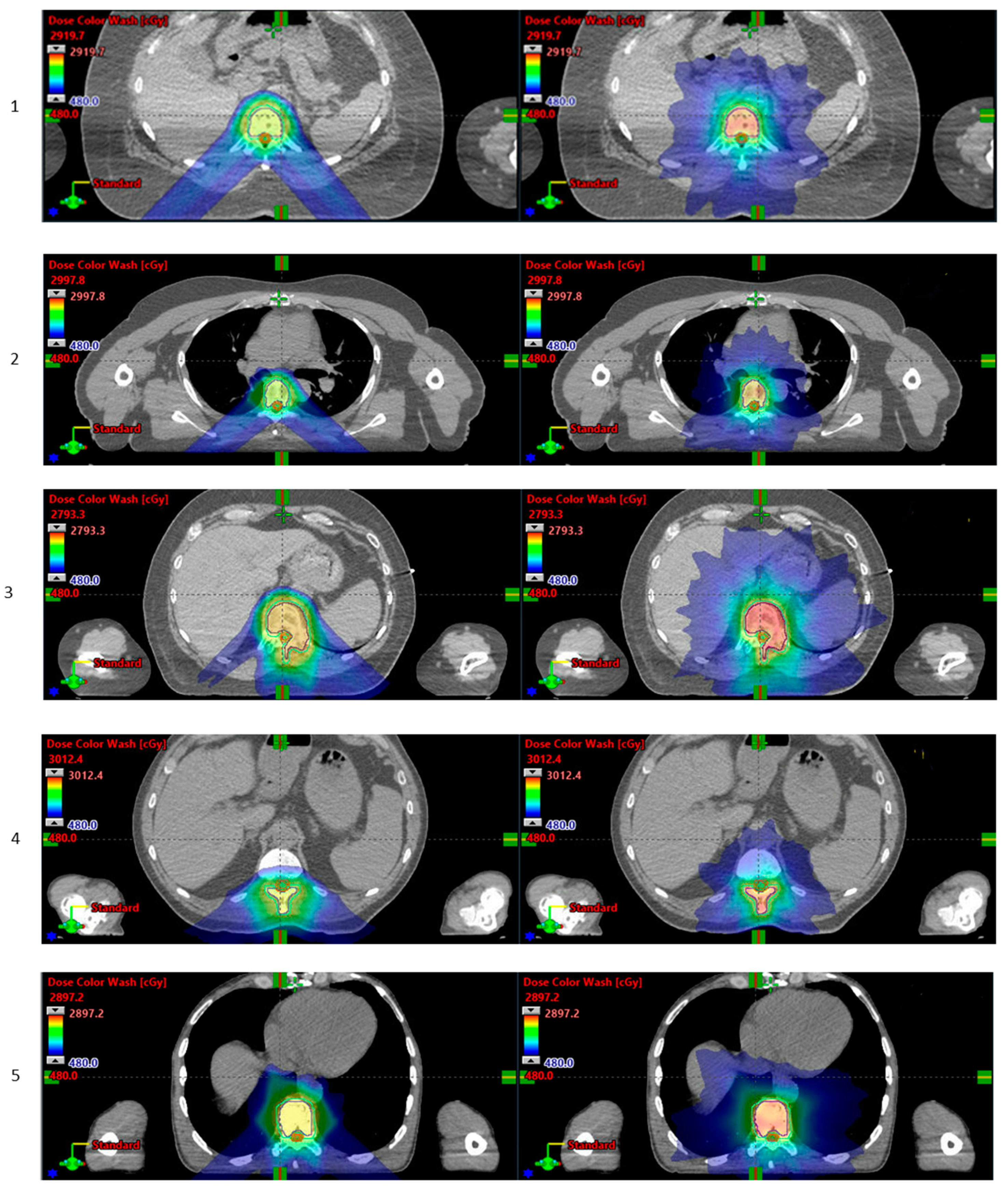 Cancers 15 02489 g002 Cancers 15 02489 g002