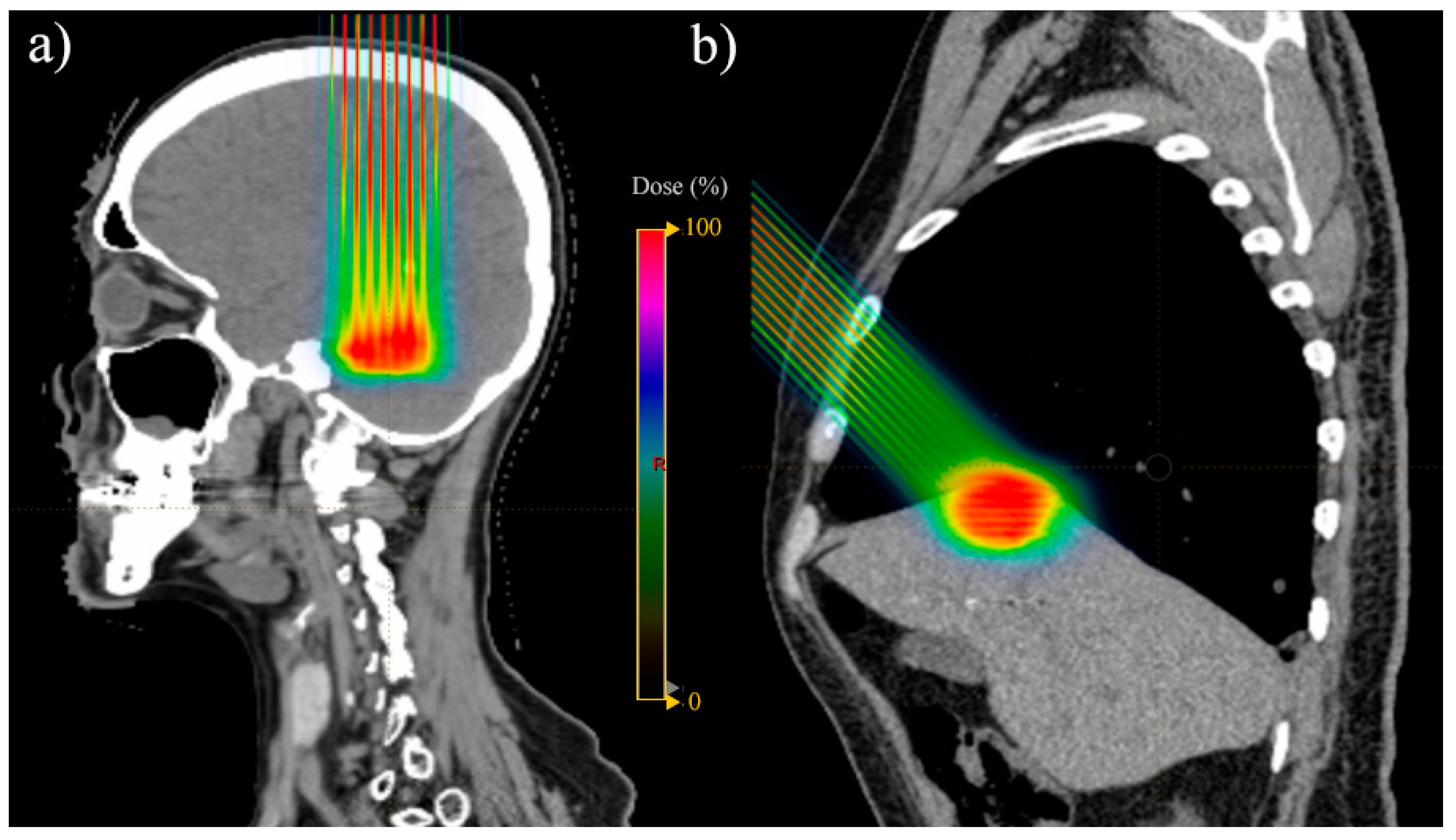 Cancers 15 02489 g003 Cancers 15 02489 g003