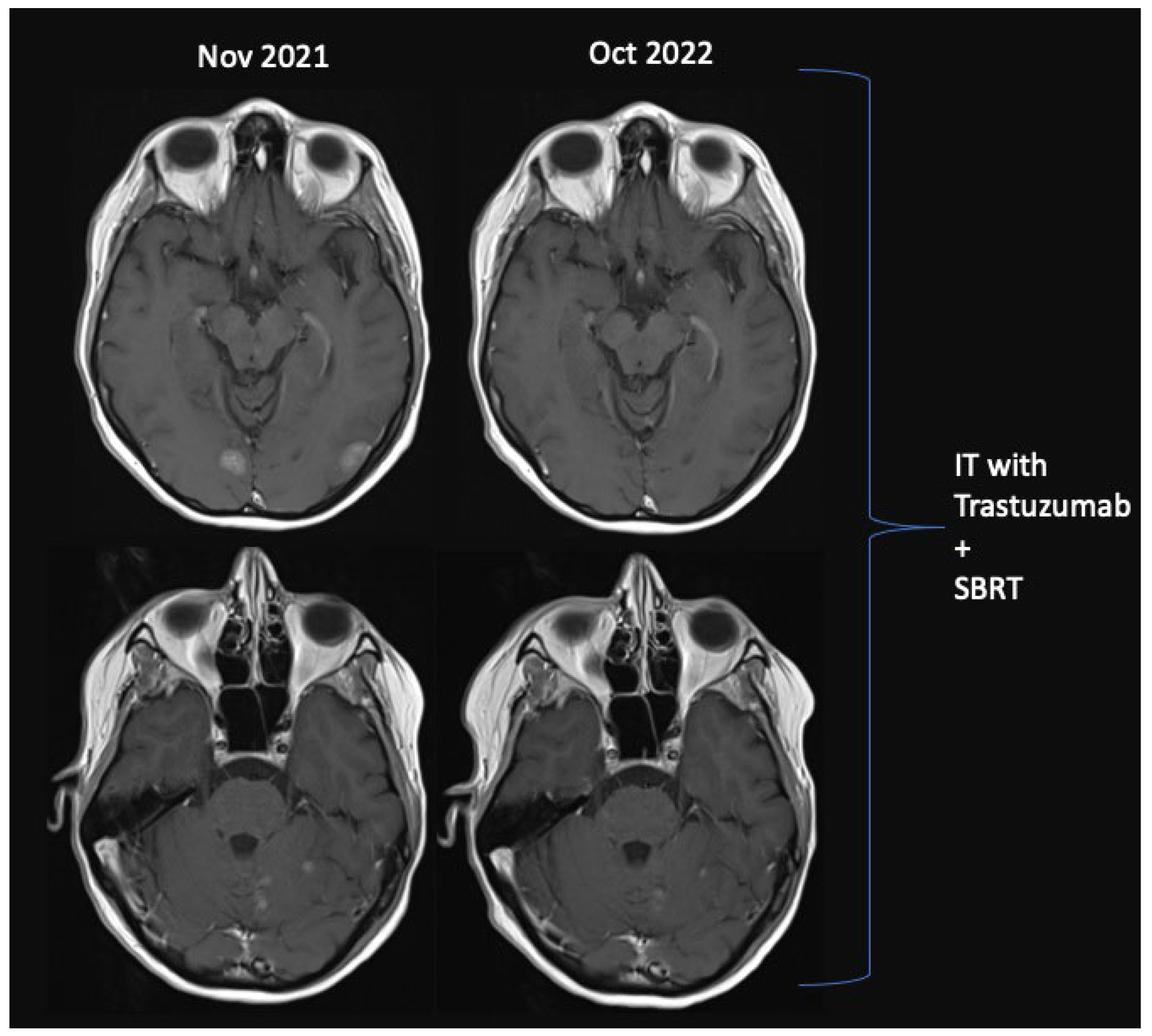 Cancers 15 02508 g002