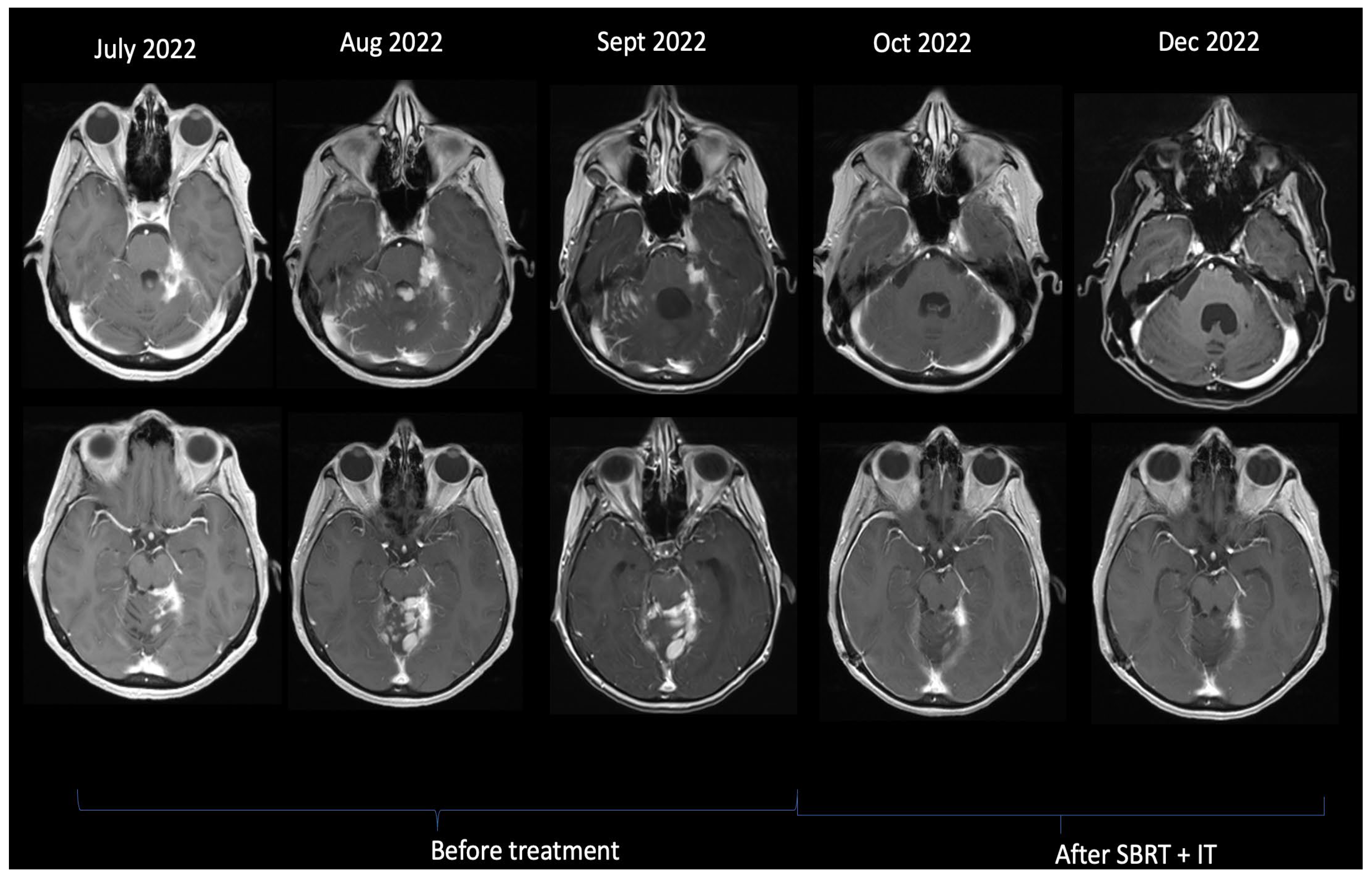 Cancers 15 02508 g003