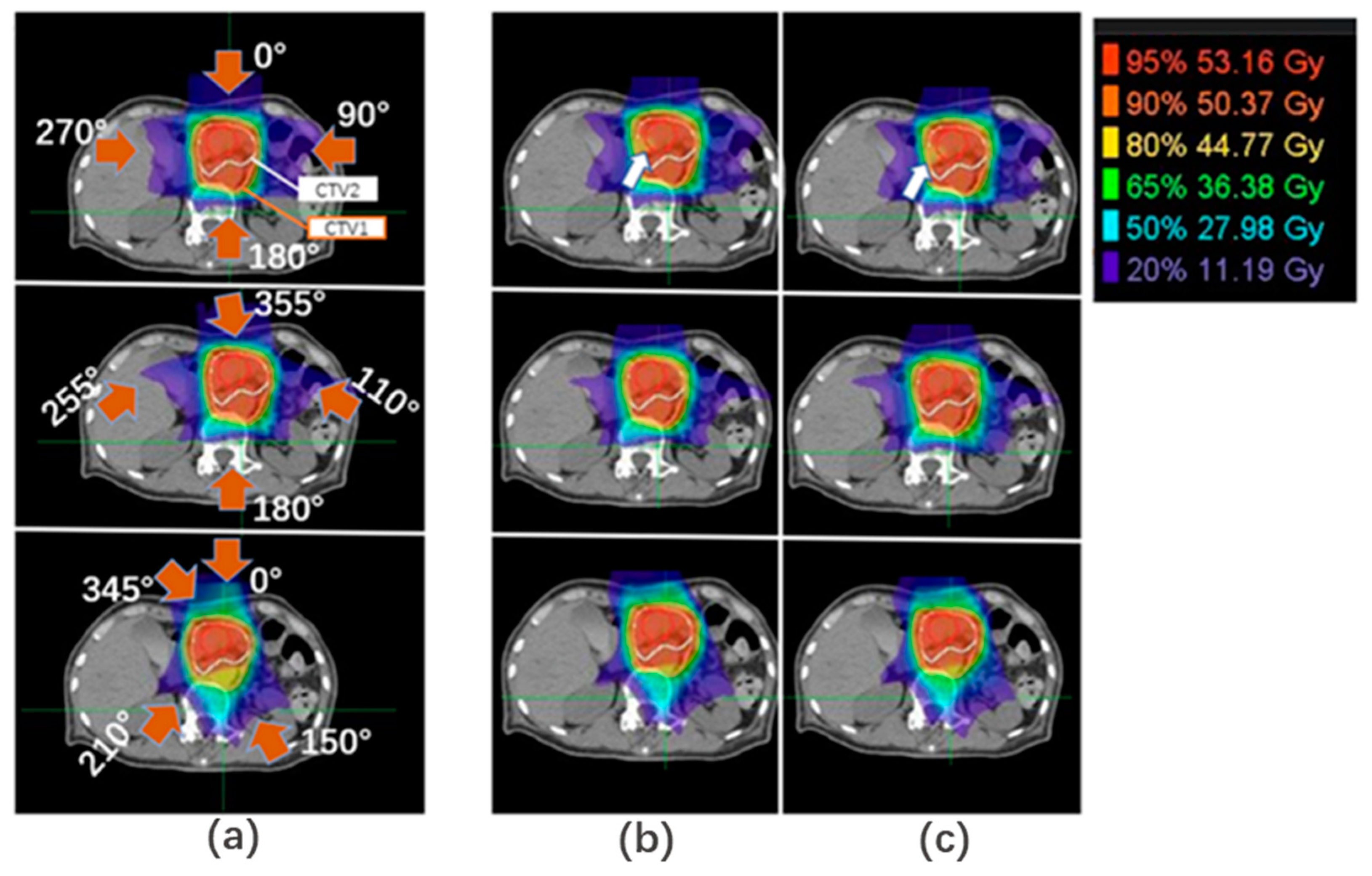 Cancers 15 02520 g004