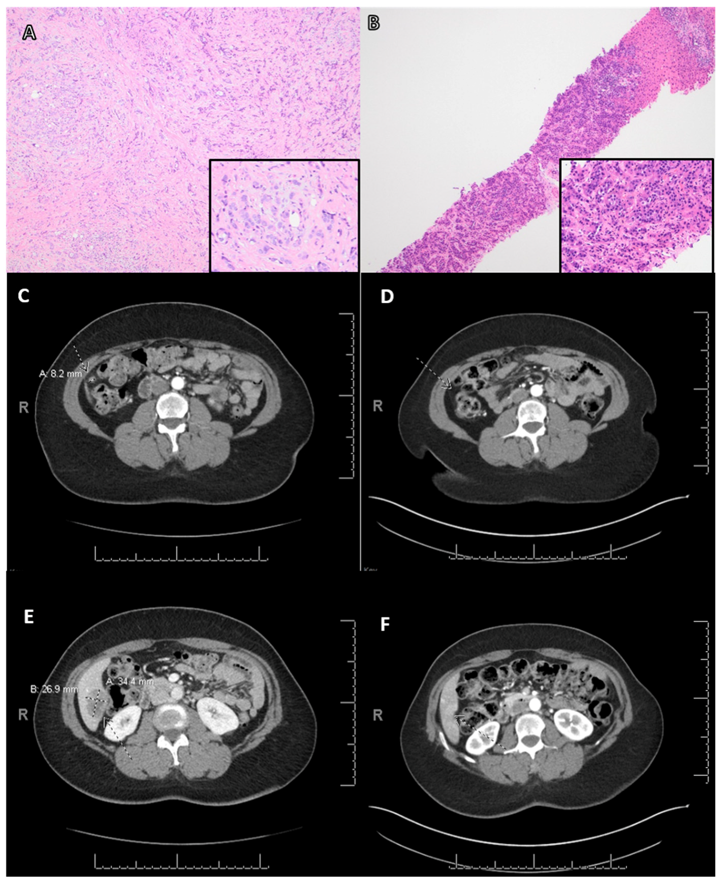 Cancers 15 02524 g003