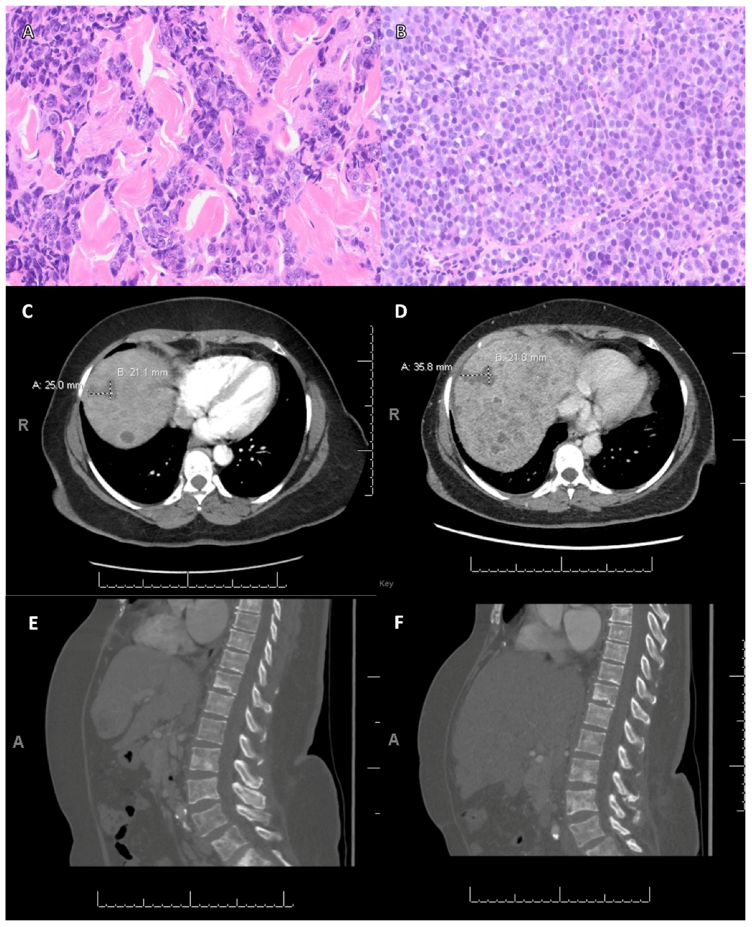Cancers 15 02524 g004