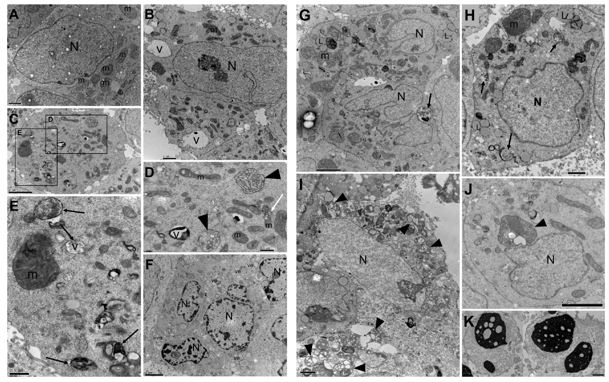 Cancers 15 02544 g003