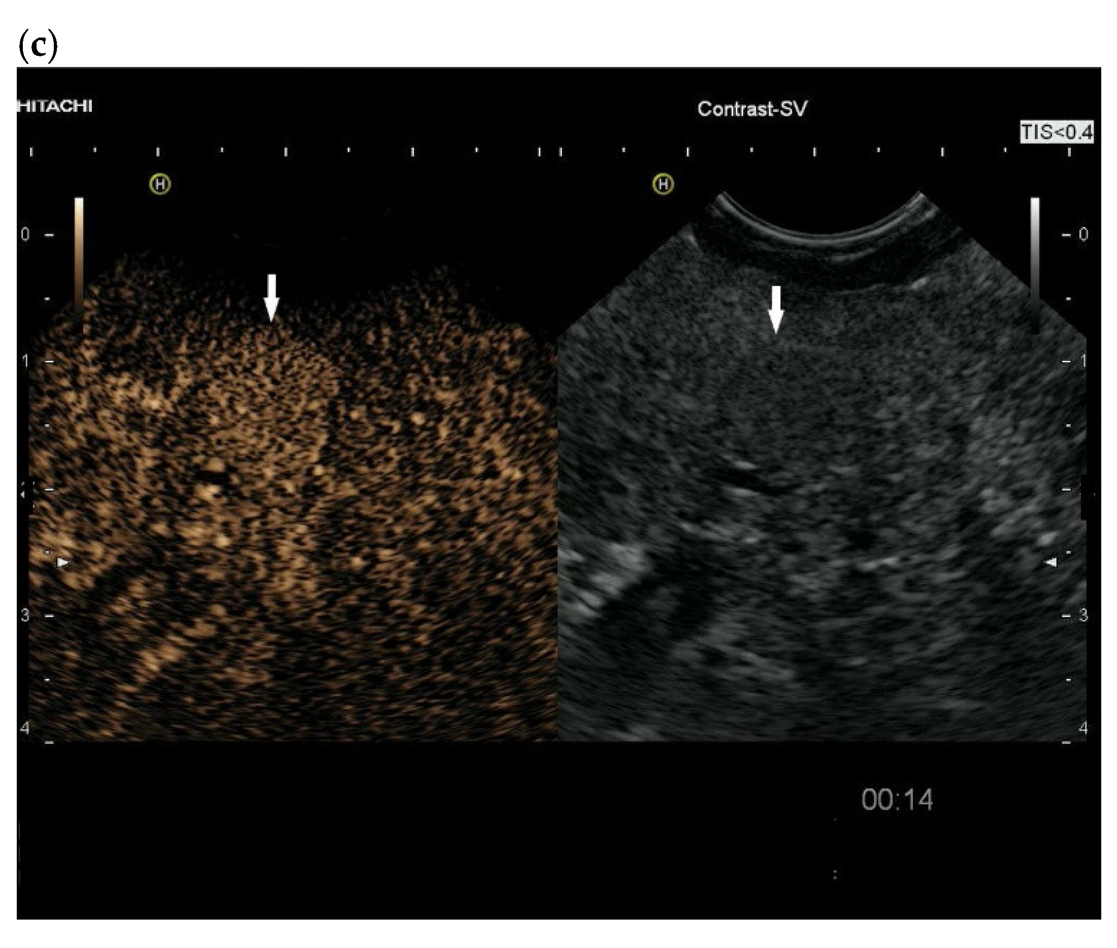 Cancers 15 02546 g003b